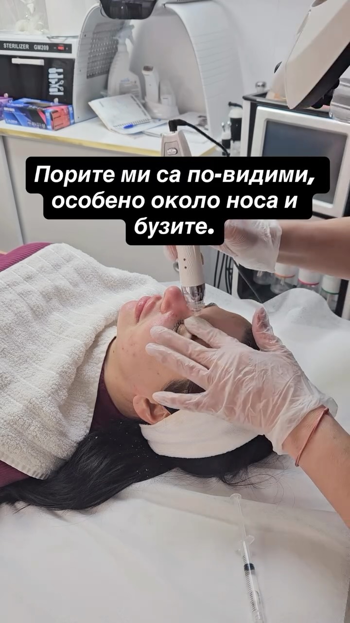 🤍 Микронидлингът с дерма пен е минимално инвазивна козметична процедура, която създава контролирани микроканали в кожата.
Това активира естествените възстановителни процеси и стимулира синтеза на колаген и еластин.
Процедурата не използва топлина или енергия, а работи механично и контролируемо, което я прави щадяща при правилно приложение.
🥰 Подходящ е при:
– загуба на плътност
– неравна текстура
– видими пори
– фини линии
– белези от акне
Резултатът е по-плътна, по-равна и по-свежа кожа. Запази час на лично
