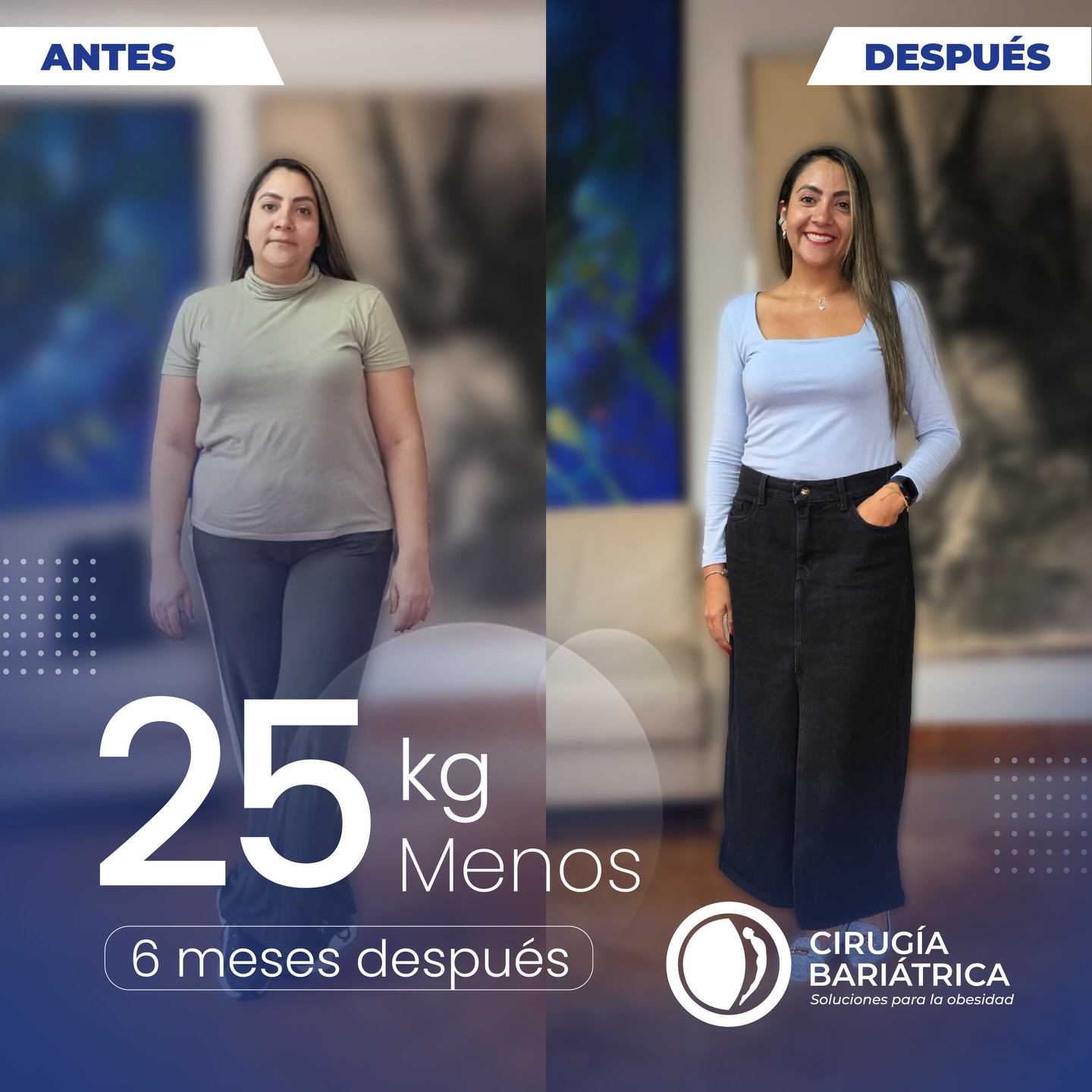 25 kilos menos en solo 6 meses 💪✨
Un cambio real, una nueva etapa y una vida que empieza a sentirse más ligera.
Gracias a la cirugía bariátrica del Dr. Bolaños y su equipo, donde la calidad, la tecnología de alto nivel y el compromiso por lograr grandes resultados se unen para transformar historias de verdad.
Esto no es solo bajar de peso, es ganar salud, bienestar y confianza. 💙
55 pounds down in just 6 months 💪✨
A real transformation, a new chapter, and a life that feels lighter every day.
Thanks to bariatric surgery with Dr. Bolaños and his team, where high-quality care, advanced technology, and a strong commitment to outstanding results come together to change lives.
This is not just about weight loss — it’s about gaining health, confidence, and well-being. 💙
Real change is possible… and it shows.
#bariatricsurgery #weightlosssurgery #bariatrica #cirugiabariatrica #weightlossjourney