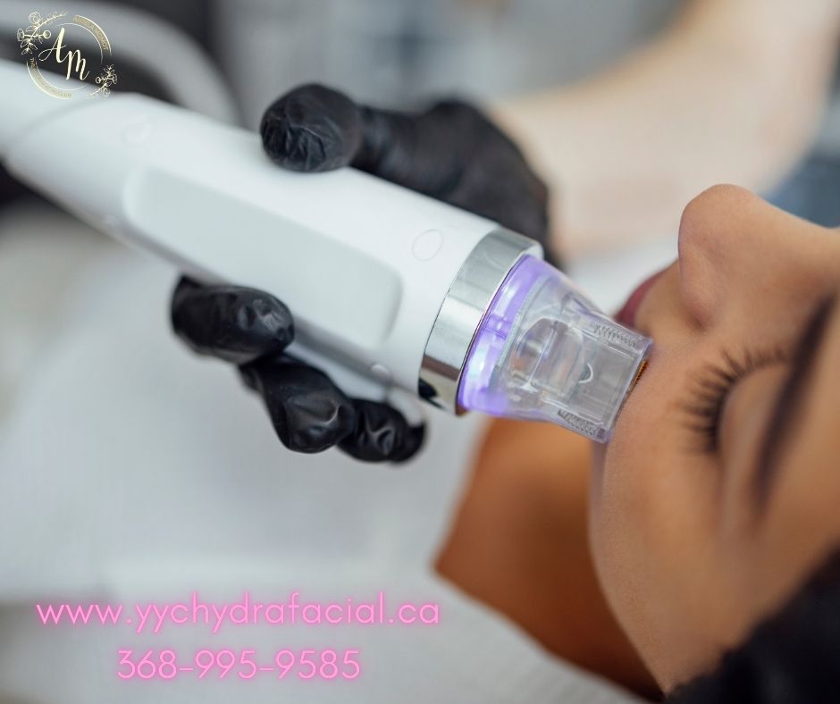 ✨ Microneedling at Hydrafacial Club ✨
Microneedling is one of the most effective treatments for improving skin texture and boosting natural collagen production.
✔ Helps reduce fine lines and wrinkles
✔ Improves skin tone and texture
✔ Minimizes acne scars and enlarged pores
✔ Enhances skin firmness and elasticity
✔ Promotes a healthy, natural glow
This treatment activates your skin’s natural healing process, delivering long-lasting, natural-looking results over time.
📍 Available for face, neck & décolleté
📅 Personalized treatment plans for every skin type
Book your microneedling session at Hydrafacial Club and give your skin a fresh start ✨ www.yychydrafacail.ca. 368-995-9585
📩 DM us to book your appointment
#HydrafacialClub #Microneedling #SkinRejuvenation #GlowingSkin #AntiAging #SkincareTreatment #selfcareroutine #Calgary#CalgaryFacials#CalgaryMicroneedling#MicroneedlingCalgary#CalgarySkinCareClinic#CalgarySelfCare#YYCMedSpa#CalgaryBeauty#CalgarySkincare#CalgaryAesthetics#CalgarySpa#CalgaryMedSpa#YYC#YYCBeauty#YYCSkincare#yycaesthetics