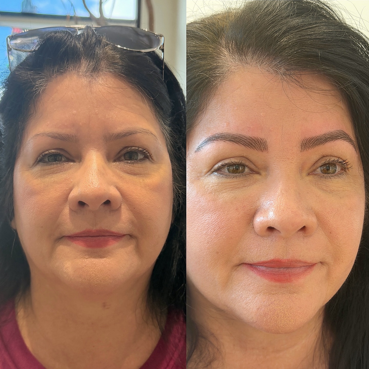 Thank you for referring me @_dv_beauty 🥰🥰
Nano Brows
• $550 (includes touchup in 6-8 weeks).
•Corrections/previous work from another artist are +$50.
•$100 deposit to schedule an appointment.
• Current clients, touchups are $250.
• If you’ve had previous work done by another artist please send a clear picture prior to scheduling.
• Appointment duration is approximately 2-2.5 hours.
• Topical anesthetic applied, minimal discomfort.
• Brows heal approximately 30-40% lighter and slightly thinner.
• Please read cancellation, late, and no show policy.
• Click “book” to schedule your appointment! Physical and E-Gift cards are also available!
.
.
.
#PowderBrows
#OmbreBrows
#Combobrows
#nanobrows
#PermanentMakeup
BrowShading
CosmeticTattoo
PowderBrowTechnique
BrowArtistry
SoftPowderBrows
EyebrowTattoo
PowderBrowSpecialist
Microblading
SemiPermanentMakeup
BrowMicroblading
EyebrowDesign
PerfectBrows
BrowTransformation
BeautyTips
BeautyHacks
NaturalBeauty
BeautyInspiration
LocalBusiness
Covinabusiness
downtowncovinabusiness
SupportLocal
CommunityBusiness