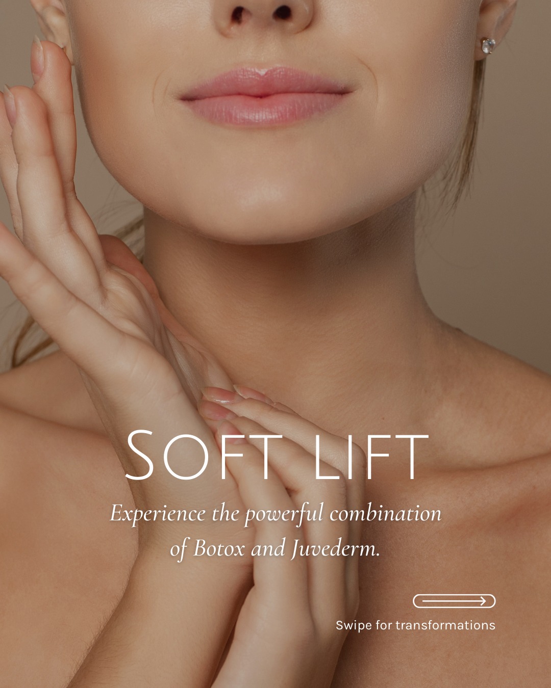 Experience the power of sculpting, lifting, and refining. ✨
Soft Lift combines the structure-building benefits of dermal filler with the muscle-relaxing precision of Botox to create a naturally youthful appearance, without ever looking overdone.
This dynamic duo works in synergy to smooth fine lines, lift , and rebalance facial proportions for results that are refreshed, refined, and unmistakably you.
These before-and-afters of View Laser patients represent the results achieved through comprehensive, physician-directed treatment plans. Because aging is a journey and your treatment plan should be just as thoughtful.
Book your Soft Lift today:
📞 Call 604-943-9399
📧 reception@viewlaser.com
#SoftLift #NaturalEnhancement #ViewLaser #DeltaLaser #Botox