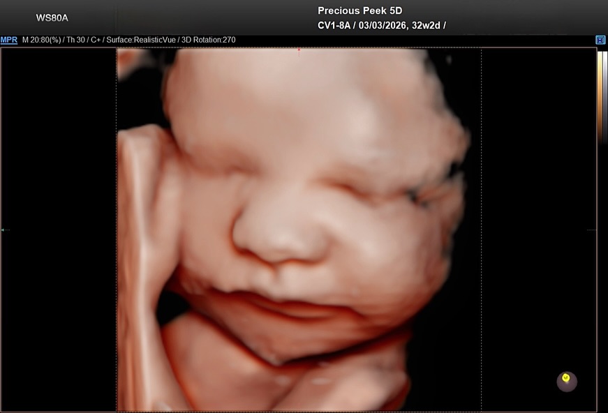 Beautiful clarity, thoughtful care, and an experience you can trust. ✨
📍 Precious Peek