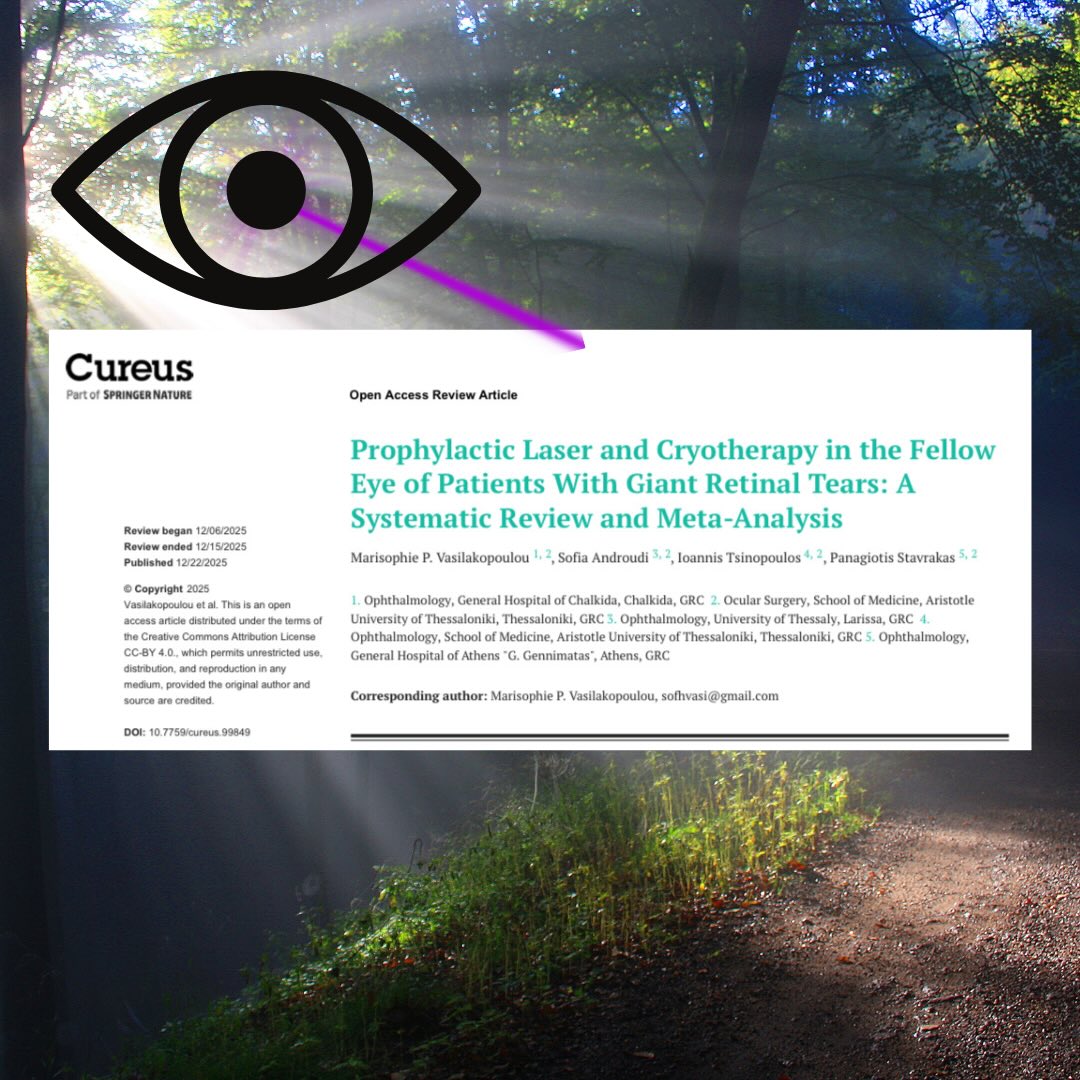 This is a useful systematic review & meta-analysis of 6 observational retrospective studies (803 fellow eyes) that shows that prophylactic laser ± cryotherapy significantly reduces the risk of retinal detachment in the fellow eye of patients with unilateral giant retinal detachment.
📉 Risk reduction ~86% (OR 0.14, p<0.001).
✅ Benefit seen with 360° laser, laser + cryotherapy or cryotherapy alone.
⚠️ Complications were uncommon and generally mild (e.g. peripheral retinal tears and epiretinal membrane)
👓 No consistent adverse visual outcomes reported.
Main takeaway from this paper is to consider prophylactic laser treatment in high risk patients (eg. stickler syndrome, high myopia or lattice degeneration) as it will be beneficial. However in lower risk patients, we have to counsel the patients carefully due to risk of visual field loss (if extensive laser) and other rare complications as described above.
#retina #vitreoretinal #retinaldetachment #giantretinaltear #eyedoctorchng