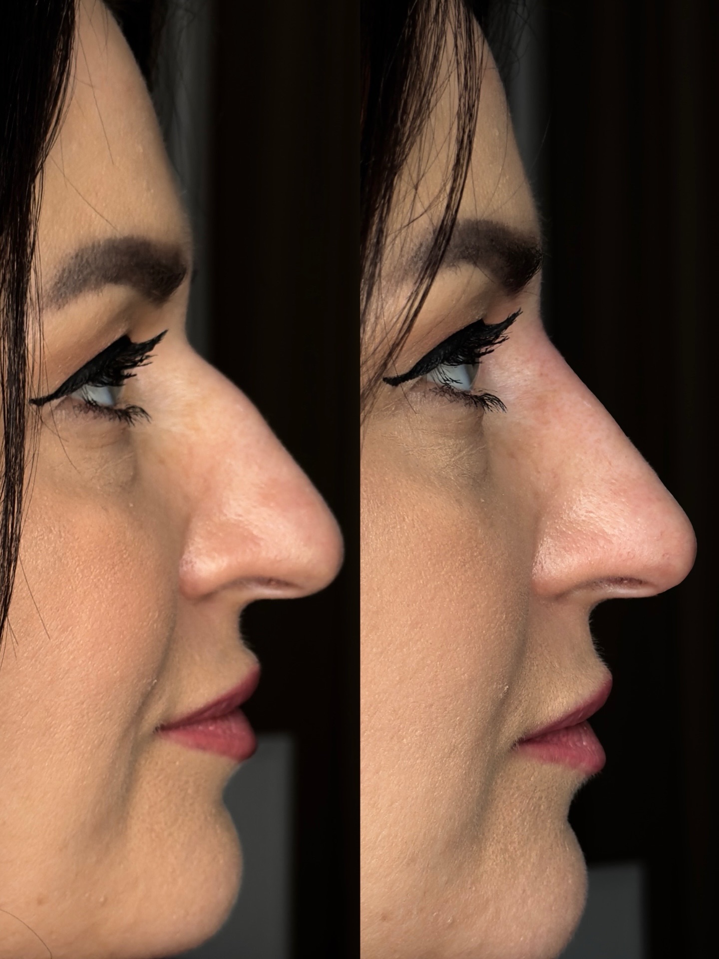 Samodzielna praca mojej cudownej @edyttaaesthetics
Ja tylko pokazywałam palcem 🔥 sama wszystko zrobiła do samiutkiego końca 💪🏻