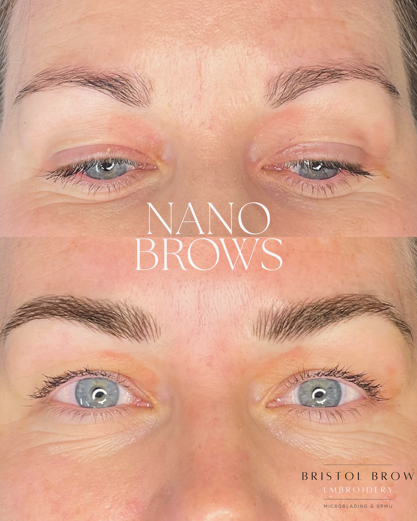 Nano Brows for Anna✨
Soft, natural, hair-like strokes designed to enhance—not overpower.
Wake up with brows that frame your face perfectly 🤍
_____________________
🗓️ BOOK NOW - Link in Bio (this shows next Availability)
🌐 Further Information on Services & Prices at www.bristolbrowembroidery.co.uk
🏡 Home-Based Studio in Westbury-on-Trym, Bristol
⭐️ Five Star Google Reviews
💬 DM or Text 07920575556 with further enquires
_______________________
#hyperrealismbrows
#hyperrealistic #homebasedstudio #bristolmicroblading #bristolbrowembroidery #semipermanentmakeup #microbladingbristol #browsonfleek #bristolbeauty #homebeautystudio #bristolmakeupartist #browtransformation #semipermanentbrows #bristolglam #microbladinguk #homesalon #naturalbrows #sculptedbrows #bristolbeautyservices #bristolbeautytherapist #browenhancement #bristolsemipermanentmakeup #nanobrows #bristolnanobrows #naturalbrows