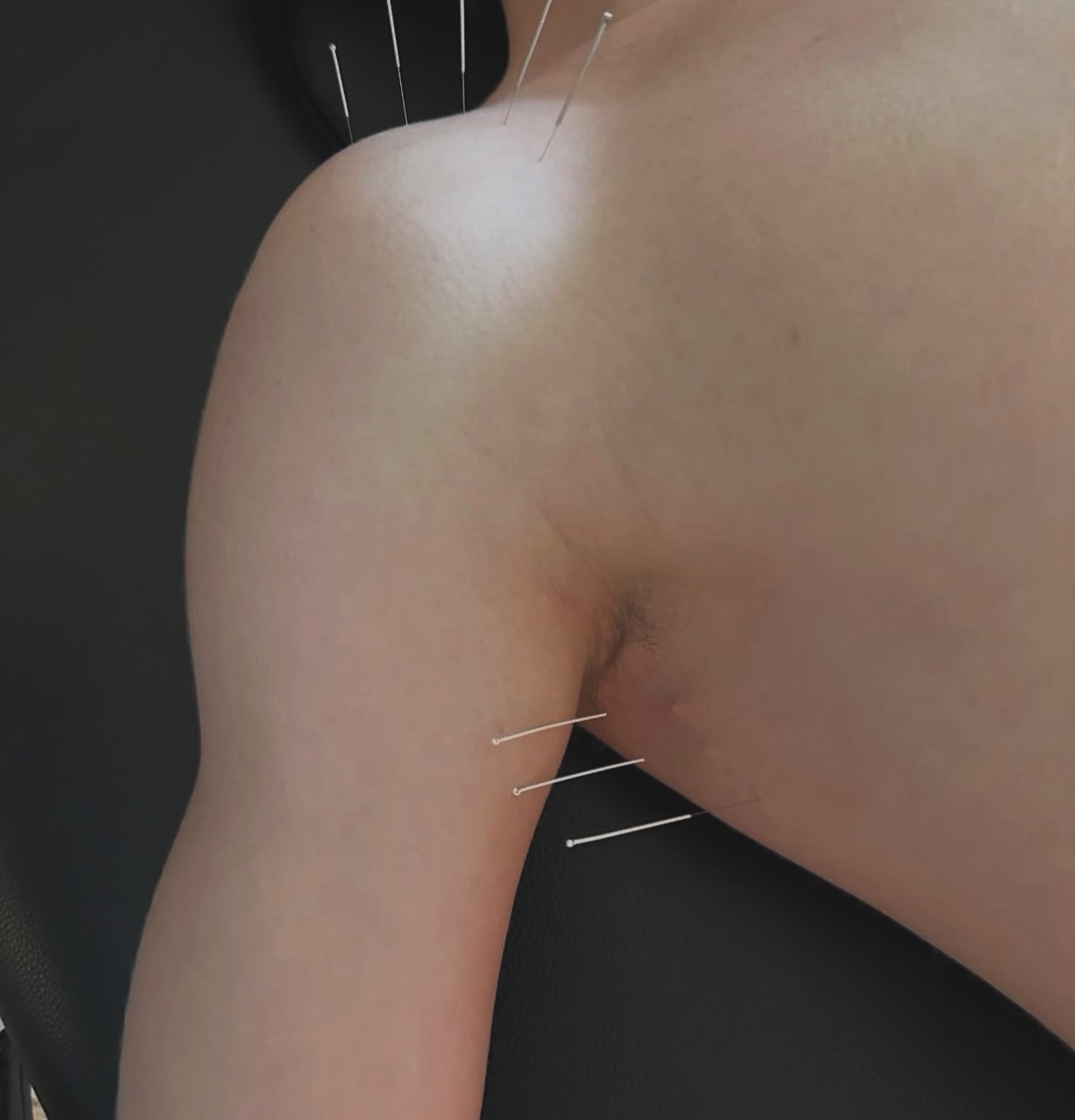 Fixing frozen shoulders and limited mobility one gentle needle at a time with the amazing @onpointdn
Come see what she can do for you!
•
•
•
#thryvewithus #cryotherapy #floattherapy #infraredsaunatherapy #compressiontherapy holistichealth holistic massage massagetherapy guasha dryneedle dryneedling shopsmall smallbusiness womenownedbusiness sensorydeprivation supportlocal moorecounty southernpines aberdeen pinehurst