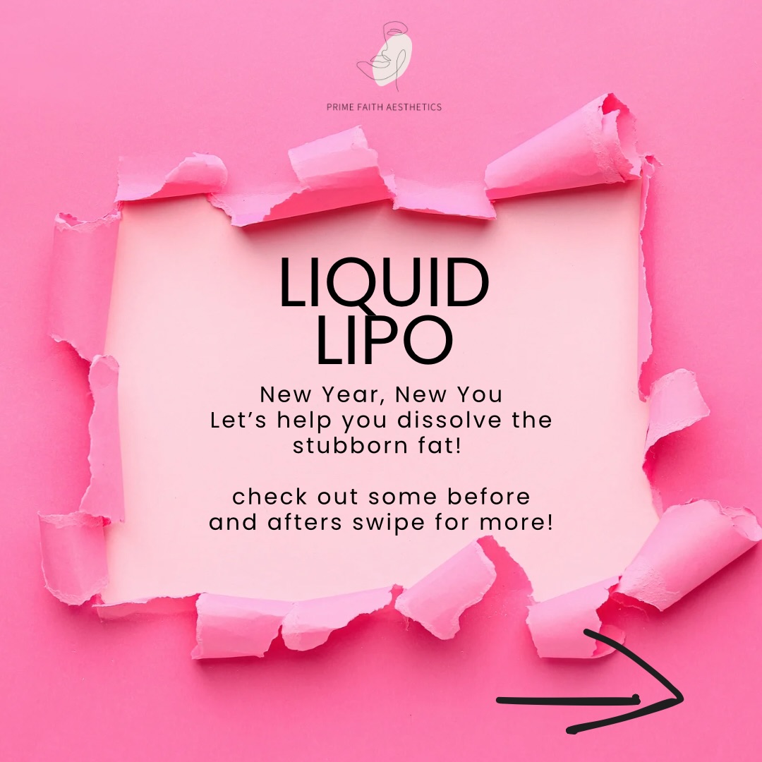 🎉NEW YEAR, NEW YOU!! Don’t wait until the new year to take action! Start your journey now with PCDC Liquid Lipo to jumpstart melting away those stubborn fat areas. If you’re unsure where to begin, feel free to reach out through the link in the bio guidance or call/text @ 469.491.9194 #lewisvilletx #dallastx #friscotx #flowermoundtx #mckinneytx