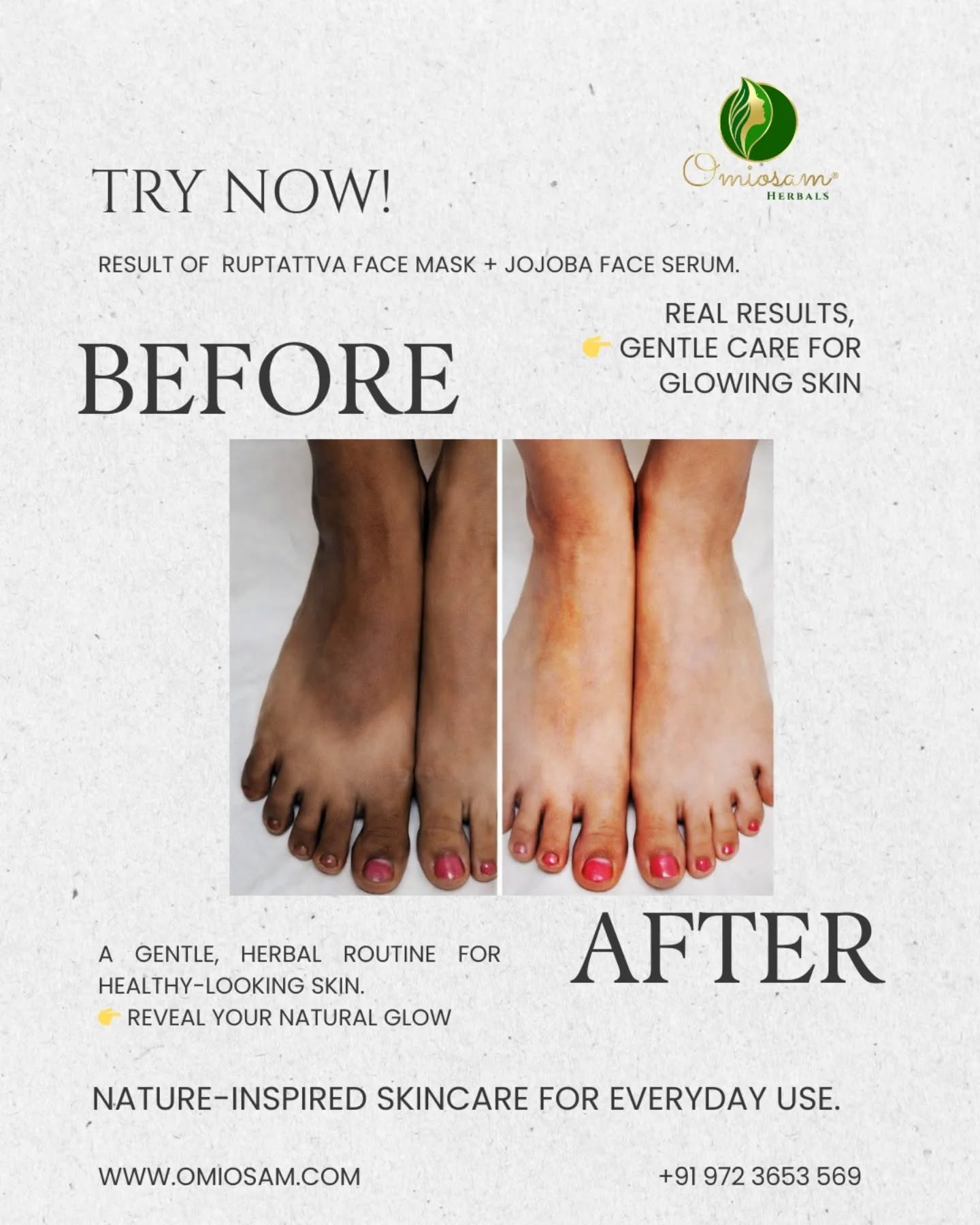 The Ruptattva Face Mask & Jojoba Face Serum Combo is a thoughtfully crafted skincare solution designed to treat and beautify the skin. The face mask works to deeply cleanse, soothe, and hydrate the skin, while the jojoba face serum helps lock in moisture and support skin repair.
✔ Suitable for all skin types
✔ Daily skincare–friendly formulation
✔ Lightweight, non-greasy serum
✔ Ideal for men and women
Shop Now
www.omiosam.com
+91 9723653569