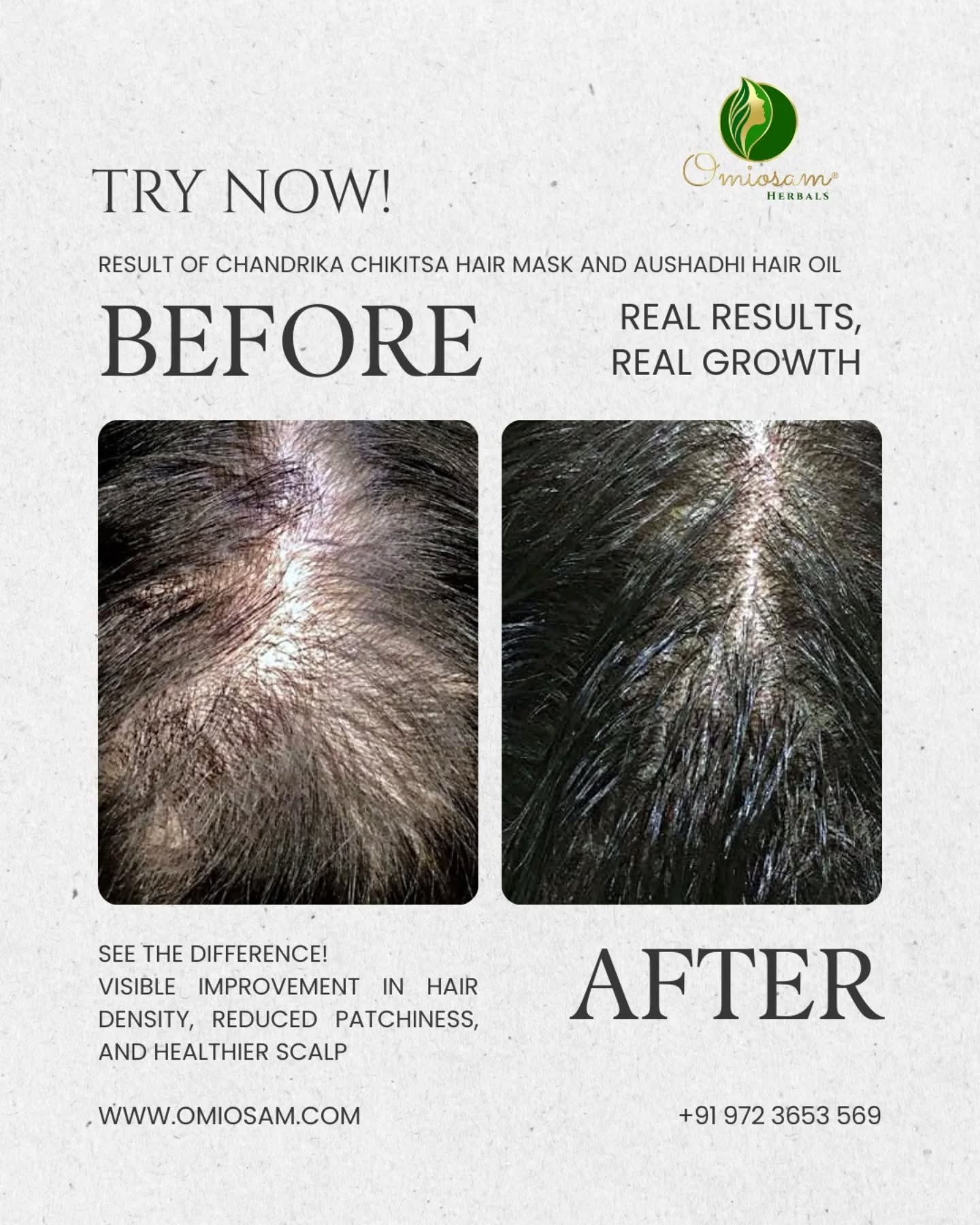 Tired of hair fall? Switch to Omiosam Hair Care Combo – a natural solution for hair fall control and scalp balance.
Shop Now
www.omiosam.con
+91 9723653569