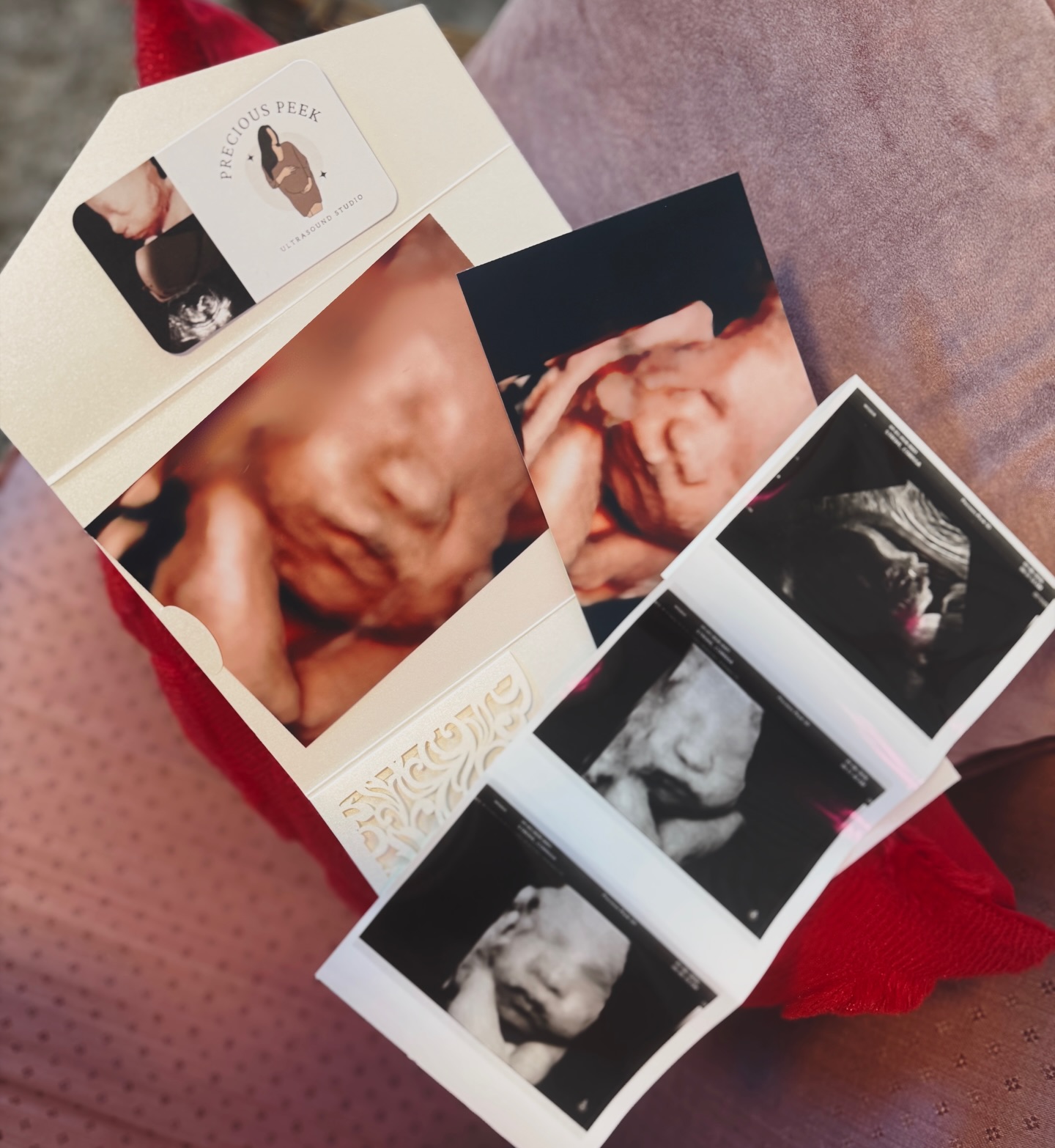 This mom is a surrogate for a family in China! The intended parents got to watch the entire session LIVE all the way from Hong Kong! 😍 A few more months and they will be able to meet their baby ❤️
#pregnant #surrogacy #ultrasound #pregnancy