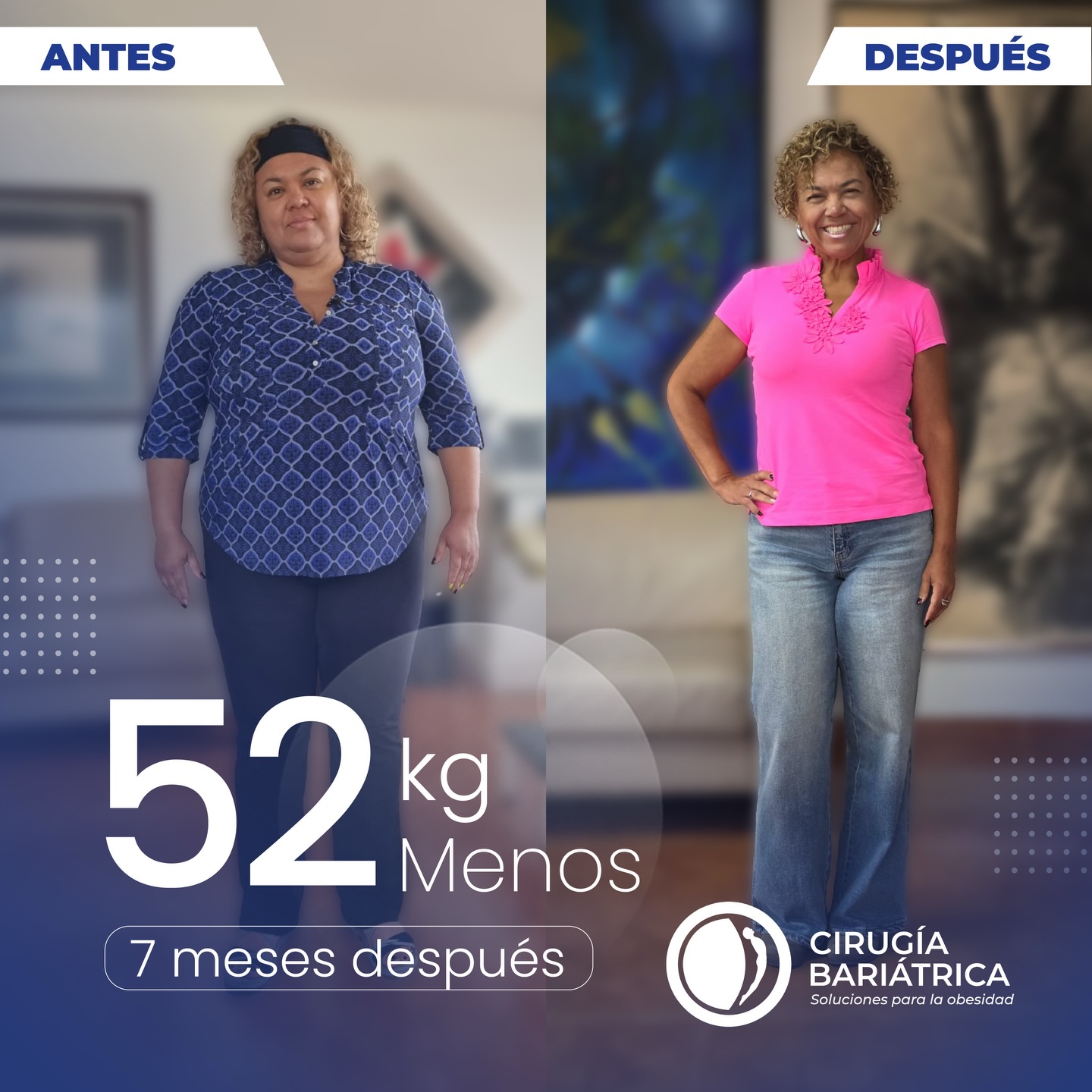 Resultados que hablan por sí solos: 52 kilos menos en solo 7 meses.👏✨
La cirugía bariátrica del Dr. Bolaños y su equipo está diseñada para lograr excelentes resultados y mejorar la calidad de vida de cada paciente, con tecnología, experiencia y compromiso.🌻
Results that speak for themselves: 115 pounds lost in just 7 months.✨👏
Bariatric surgery by Dr. Bolaños and his team is designed to achieve excellent results and improve each patient’s quality of life, through technology, experience, and commitment.🌻
#bariatric #bariatricsurgery #weightlosssurgery #weightlosssupport #cirugiabariátrica
