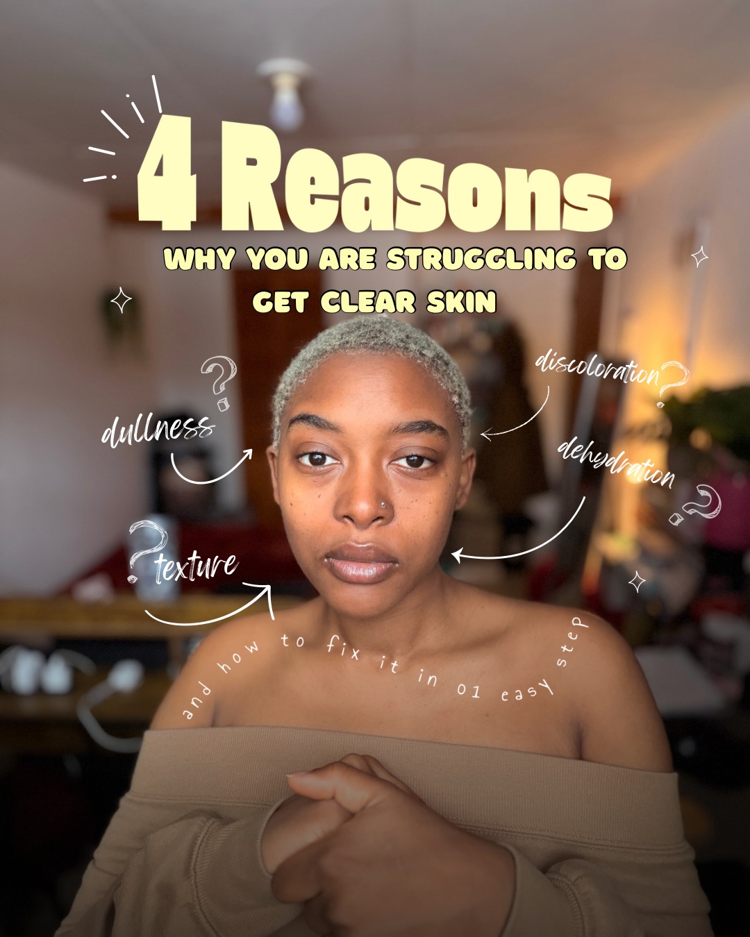 The choice of your moisturizer can be fundamental to how your skin will respond to treatment.
Thing of it as the last barrier to ensure all your other actives can be absorbed and act they way they should for permanent results
One moisturizer that I’m currently using with satisfactory results is the @skin1004official Probiotic-Cica Enrich Cream
#skinbarrier #clearskin #glassskin #skin1004