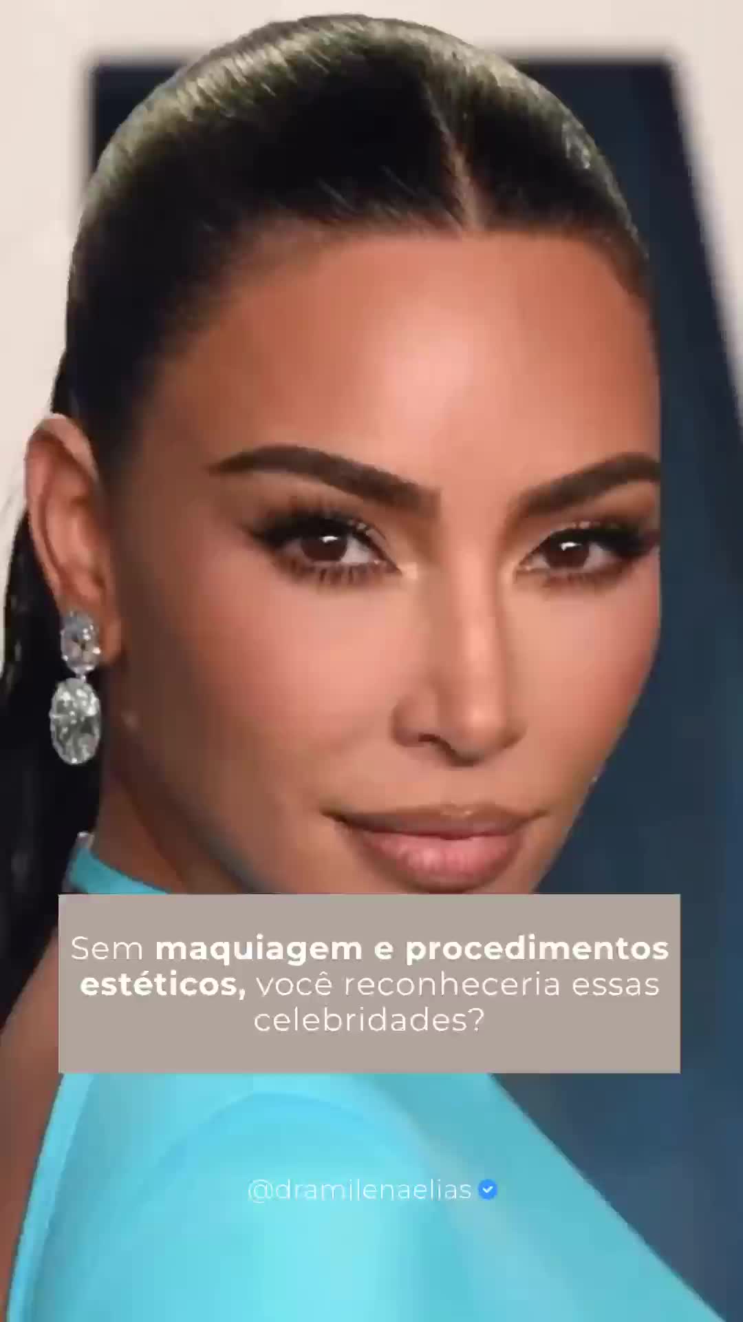 Você já se pegou se comparando com famosas, achando que só elas “acordam prontas” e que você está sempre atrás?
Essa montagem mostra como essas mesmas mulheres poderiam parecer sem maquiagem e sem procedimentos estéticos, bem mais próximas da realidade de qualquer pessoa. A ideia não é criticar, mas lembrar que, por trás dos filtros e da produção, todo mundo é humano e que a beleza real não é feita para ser perfeita, e sim coerente com quem você é.
Se você quer entender como cuidar da sua aparência de forma consciente, sem perder sua identidade, agende uma consulta e vamos conversar sobre o que faz sentido para o seu rosto e para o seu momento.
