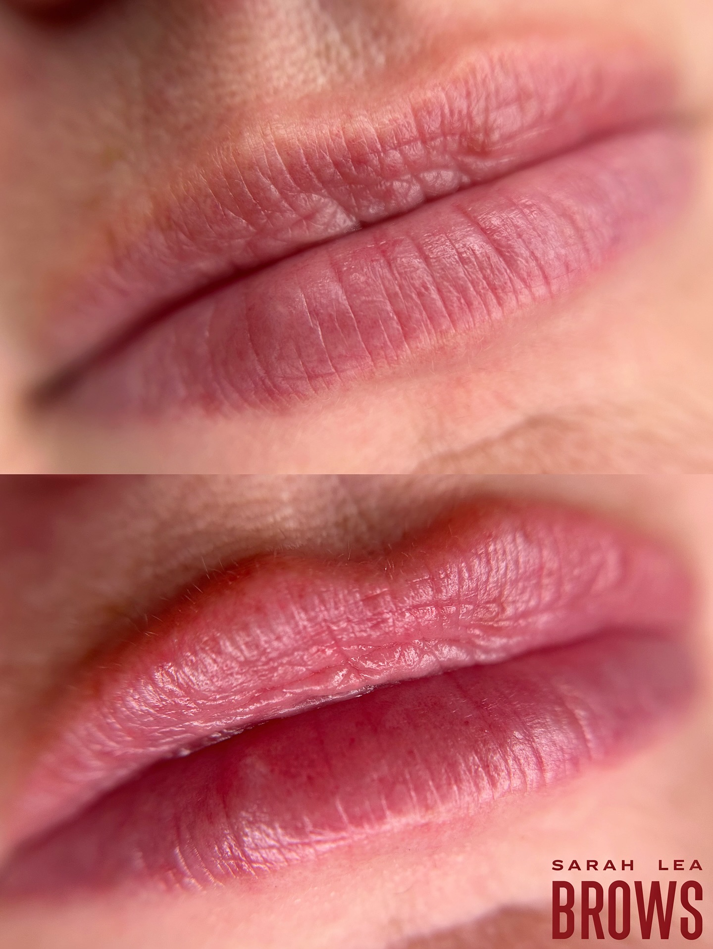 Healed lip blush after one session on my gorgeous client. She did also have a little filler done (@aylas.aestheticss ) between her before and after here, hence the more defined cupids bow. Filler and lip blush are a match made in heaven, tbh. But you can see we have neutralised those purple undertones and added a super natural rosey flush to her lips which has overall brightened her complexion, her lips look more even in tone, volume is increased (this is also helped with the addition of filler too, of course). This is natural and undectable work that just brightens your face overall but without looking like youâve had somthing done and therefore being distracting. My kind of jam!
~ Lip Blush Tattoo
~ Completely customised colour and shape to suit each individuals wants/needs. Appears bold for 5 days but heals to a soft flush of colour similar to that of a tinted balm
~ Artist: Sarah Lea
~ Lasts 2+ years
~ Anaesthetic used throughout
~ Southport, Gold Coast
~ Bookings & Info:
www.sarahleabrows.com