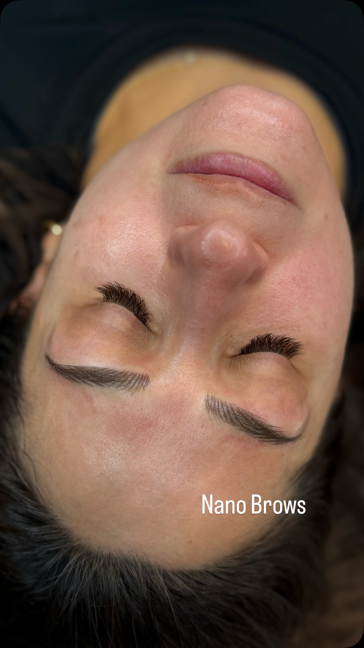 What is nano brows vs microblading ?
Nanobrows and microblading are both two forms of semi permanent makeup that give a more full, structured brow using hair strokes that look like real hair.
Microblading is done with an actual blade. This style of PMU(permanent makeup) was created to be only as deep as a paper cut, and only meant to last up to 6 months. This is because of the fact that the hairstrokes are created with a blade, and any deeper, will cause scarring over time.
Nano brows are done with what’s called a rotary machine device, and ink is implanted using a needle. This allows for ink to reach a deeper level in the skin without causing scarring. This technique is created to last up to a year .
If you’ve had microblading in the past and notice your hairstrokes are blurred, your brows feel raised, or you have a murky color, you may need a touch up; it’s because the blading is causing some scarring and is effecting the color.
If you’ve done nano brows, you’re in luck because nano brows does not typically result in scaring however if the color is faded and the hairstrokes aren’t crisp, then you need a touch up.
It can take up to 3 sessions to get the perfect look.
Microblading is best for balanced skin that is normal and minimal signs of aging.
Nanobrows can work for any skin type.
Permanent brows may be a good option for you if your are unhappy with your shape abd want something natural that will flatter your face without being overwhelming.
At KemSkin Total Beauty, my Home Spa I specialize in nano brows for women over 30. If you’re interested in learning more about your brow options, let’s schedule a free consultation #Brows #nanobrows #kemskin