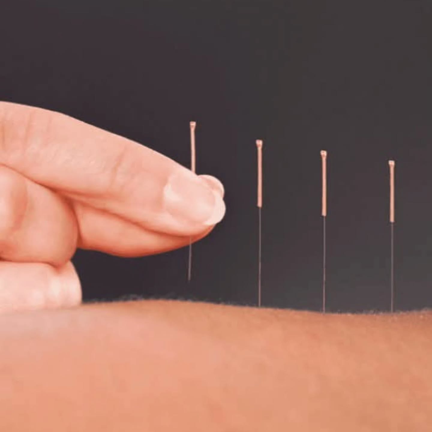 ✨️ NEW TO GRC: ACUPUNCTURE ✨️
Booking with Renee of Matsu Bodywork now open for Tuesdays beginning 1/20!
Call or text 918-519-1163