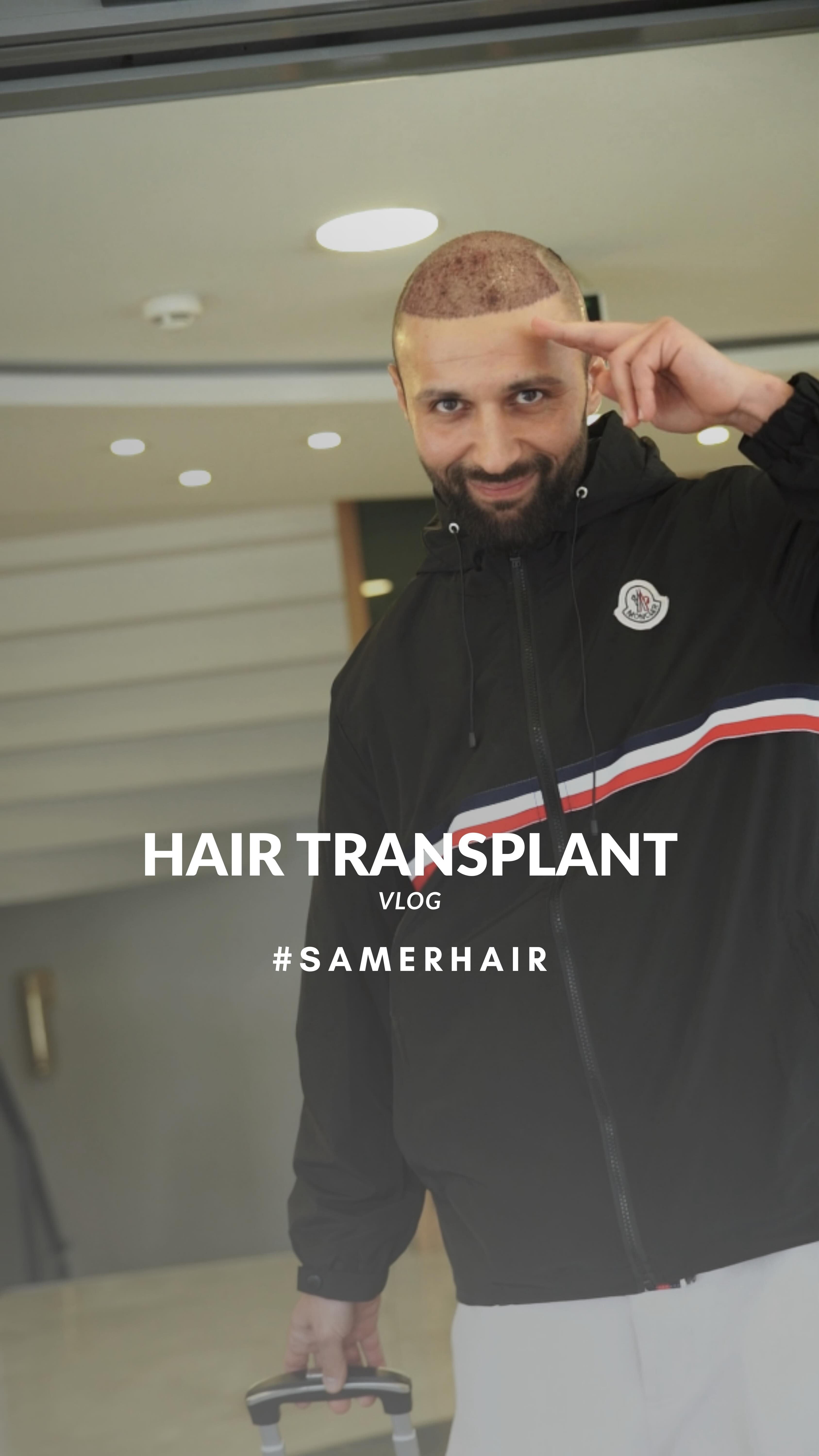 Güçlü saçlar, güçlü bir sen 💪🧑🦱
Strong saç, a stronger you 💪🧑🦱
Сильные волосы — сильный ты 💪🧑🦱
-
-
-
-
-
#hairtransplant #hairtransplantturkey #saçekimi #istanbulhair #beforeafter