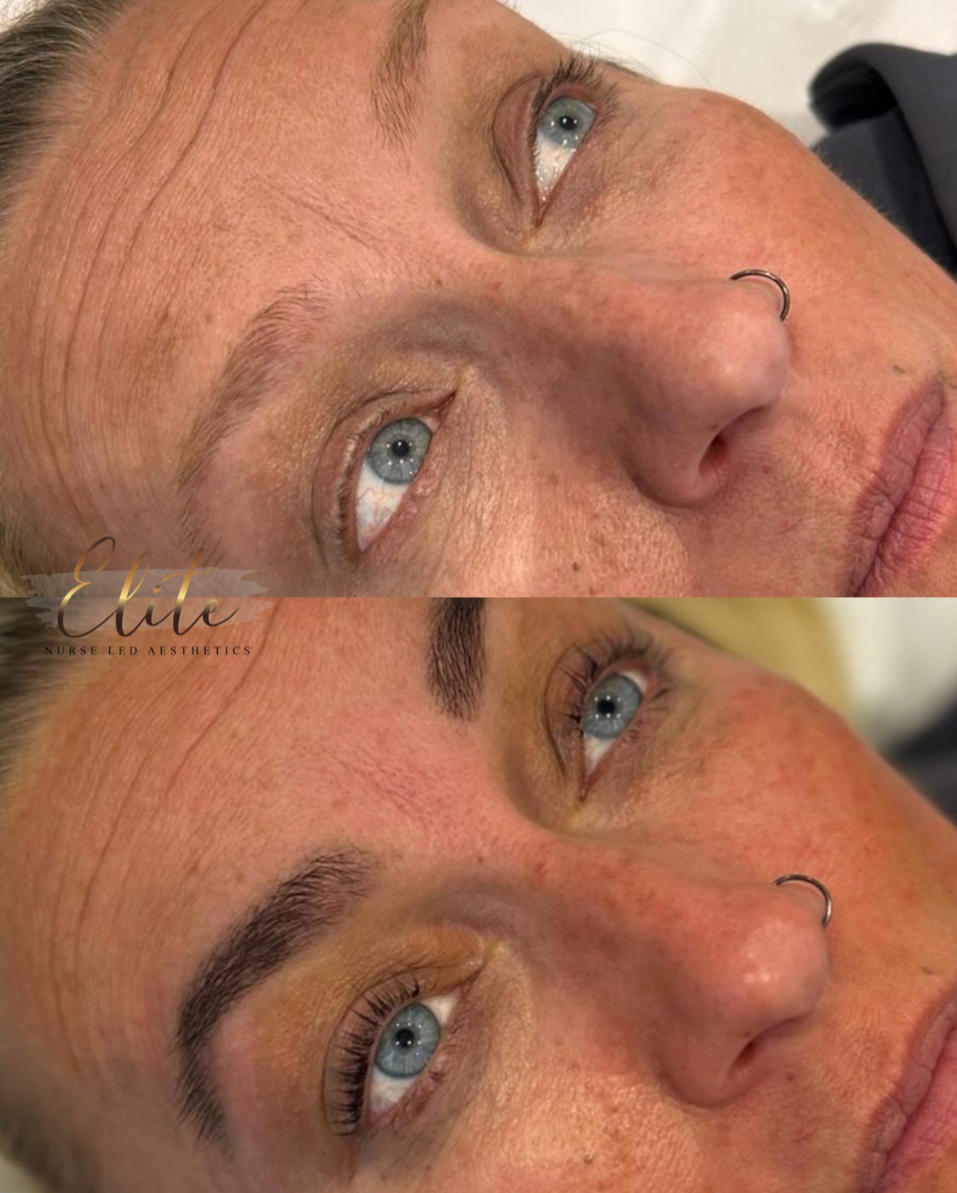 Want effortless lashes and brows that look done every day? ✨
A lash lift & brow treatment enhances your natural features — lifting, shaping, and defining without extensions or heavy makeup.
Who is it perfect for?
✔️ Anyone wanting low-maintenance beauty
✔️ If your lashes are straight, flat, or grow downward
✔️ If your brows lack shape or definition
✔️ Busy lifestyles who want to wake up ready
✔️ Anyone wanting a natural, polished look
Results are soft, flattering, and long-lasting — ideal if you love a fresh, natural finish 🤍
💬 DM “LASH & BROWS” to book your appointment or ask any questions.
📍 Wakefield
📍 Elite Nurse Led Aesthetics
#EliteNurseLedAesthetics #WakefieldBeauty #LashLiftWakefield #BrowGoals #NaturalEnhancement