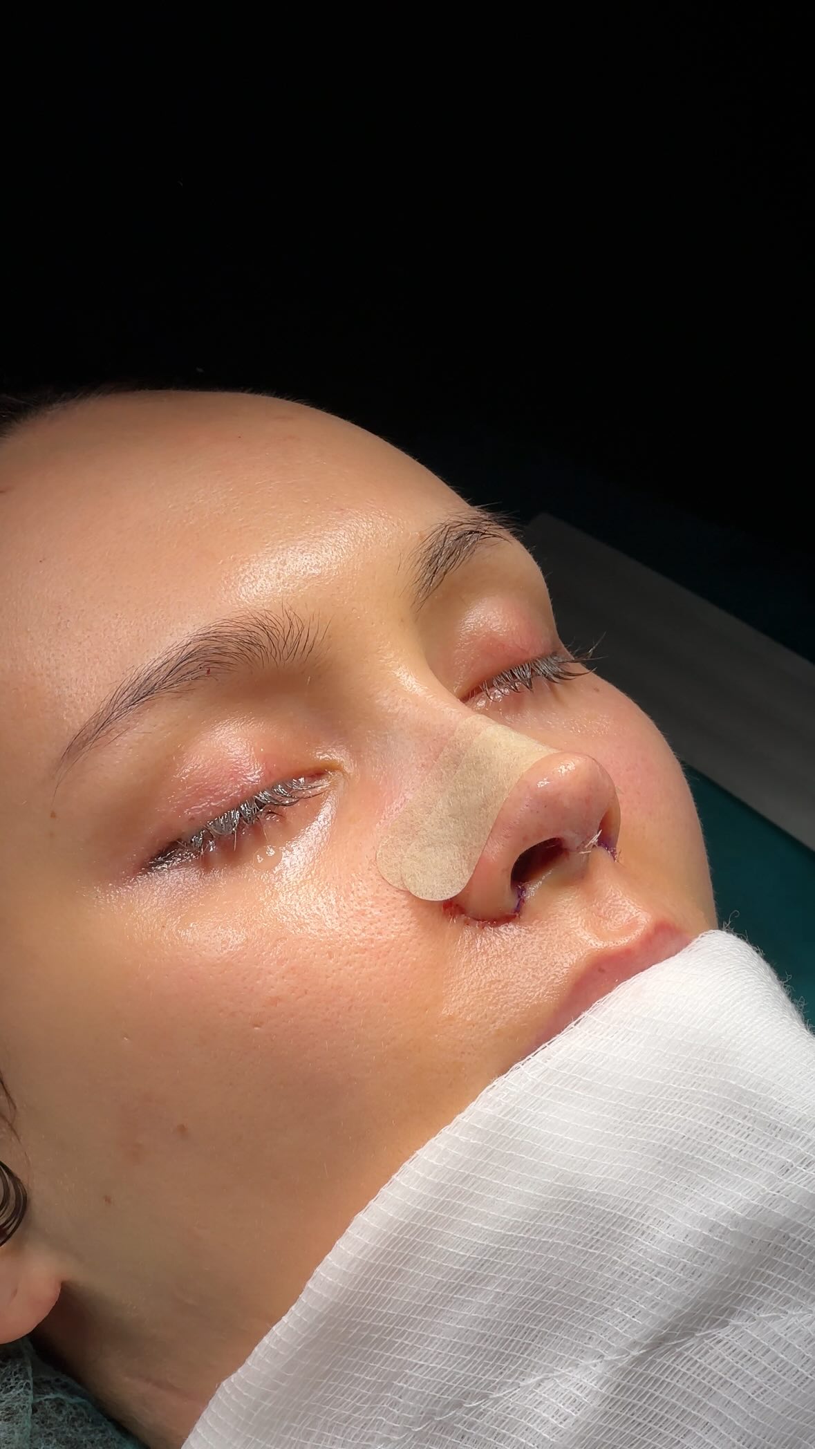 Barbie nose⭐️
From UK🇬🇧