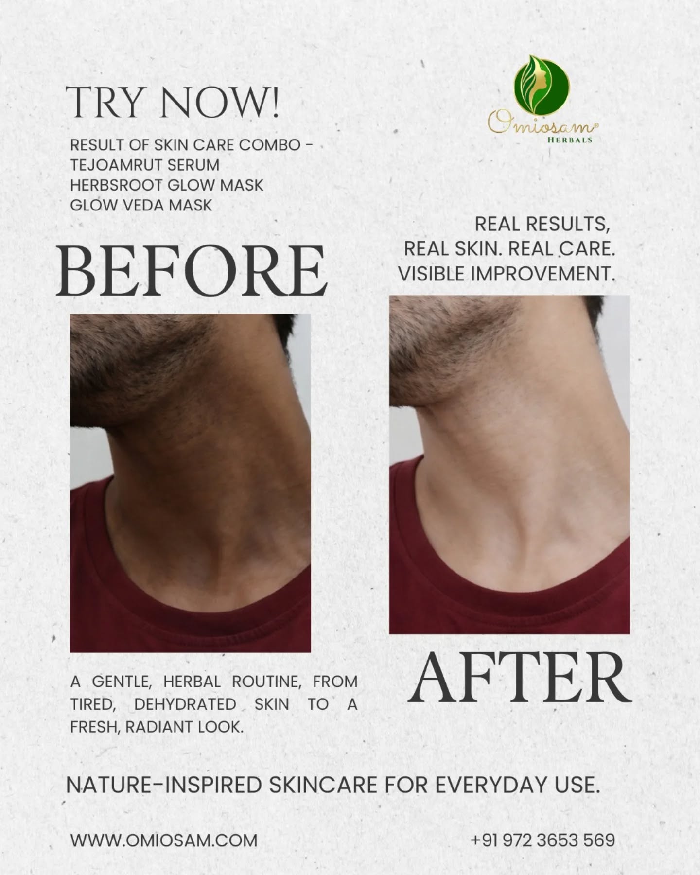 Happy real glow and confidence.
Thousands of happy clients experiencing healthier, glowing skin every day.
Client-approved skincare that nourishes, protects, and enhances natural beauty.
Shop 🛒 Now
www.omiosam.com
+91 9723 653 569