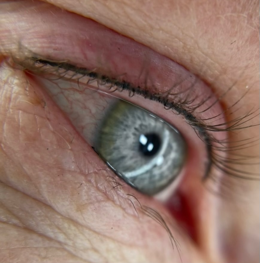 LASH LINE ENHANCEMENT.
☝🏼Does it look like eyeliner?
✋🏼No — not unless you ask for that.
🤌🏼Lash line enhancement sits inside the lash roots, not above them.
This means no visible “line,” no wing, no makeup look — just naturally darker lashes.
👉🏼Think: “Your lashes… but better.”
Book in Now!
#lashlinetattoo