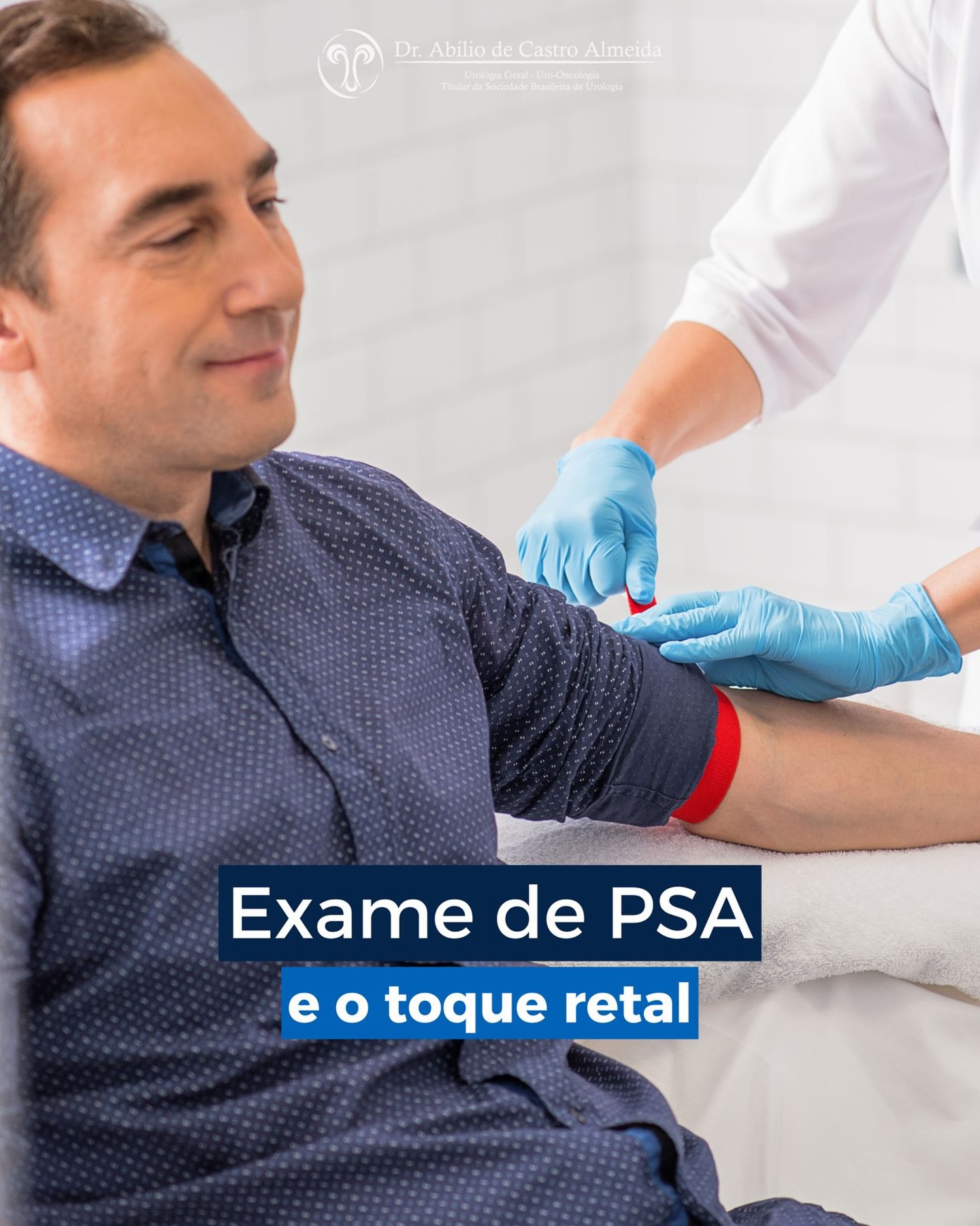Quando falamos em prevenção e diagnóstico precoce das doenças da próstata, dois exames são fundamentais: o PSA e o toque retal. Cada um avalia aspectos diferentes — e um não substitui o outro.
🧪 PSA (Antígeno Prostático Específico)
É um exame de sangue que mede uma substância produzida pela próstata.
Ele ajuda a identificar alterações que podem indicar inflamação, aumento benigno ou câncer.
➡️ Porém, o PSA pode estar normal mesmo em alguns casos de câncer.
🩺 Toque retal
Permite ao médico avaliar diretamente a próstata, observando tamanho, consistência e presença de nódulos.
➡️ Algumas alterações só são percebidas ao exame físico, mesmo com PSA normal.
🔍 Por que realizar os dois?
✔️ O PSA analisa alterações bioquímicas
✔️ O toque avalia alterações estruturais
✔️ Juntos, aumentam significativamente a chance de diagnóstico precoce
📅 A recomendação geral é iniciar o acompanhamento a partir dos 50 anos, ou 45 anos para homens com histórico familiar de câncer de próstata.
👉 Prevenção é informação, cuidado e atitude.
#Urologia #SaúdeDoHomem #PSA #ToqueRetal #Prevenção DiagnósticoPrecoce CâncerDePróstata