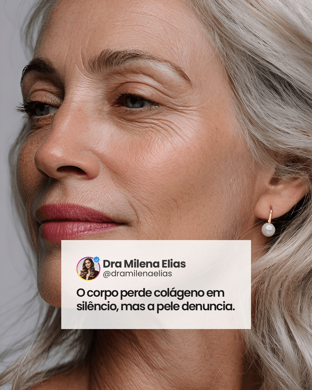 Você já reparou como algumas áreas do corpo vão perdendo firmeza mesmo quando seguimos cuidando bem da saúde?
Essa mudança não é apenas estética — muitas vezes, ela afeta também como nos sentimos diante do espelho e nas roupas do dia a dia.
Existe tecnologia para isso. Mas o mais importante é entender que sentir-se bem com o próprio corpo também faz parte do autocuidado.
Comenta aqui: você já notou essa perda de firmeza em alguma região? Vamos conversar sobre isso.