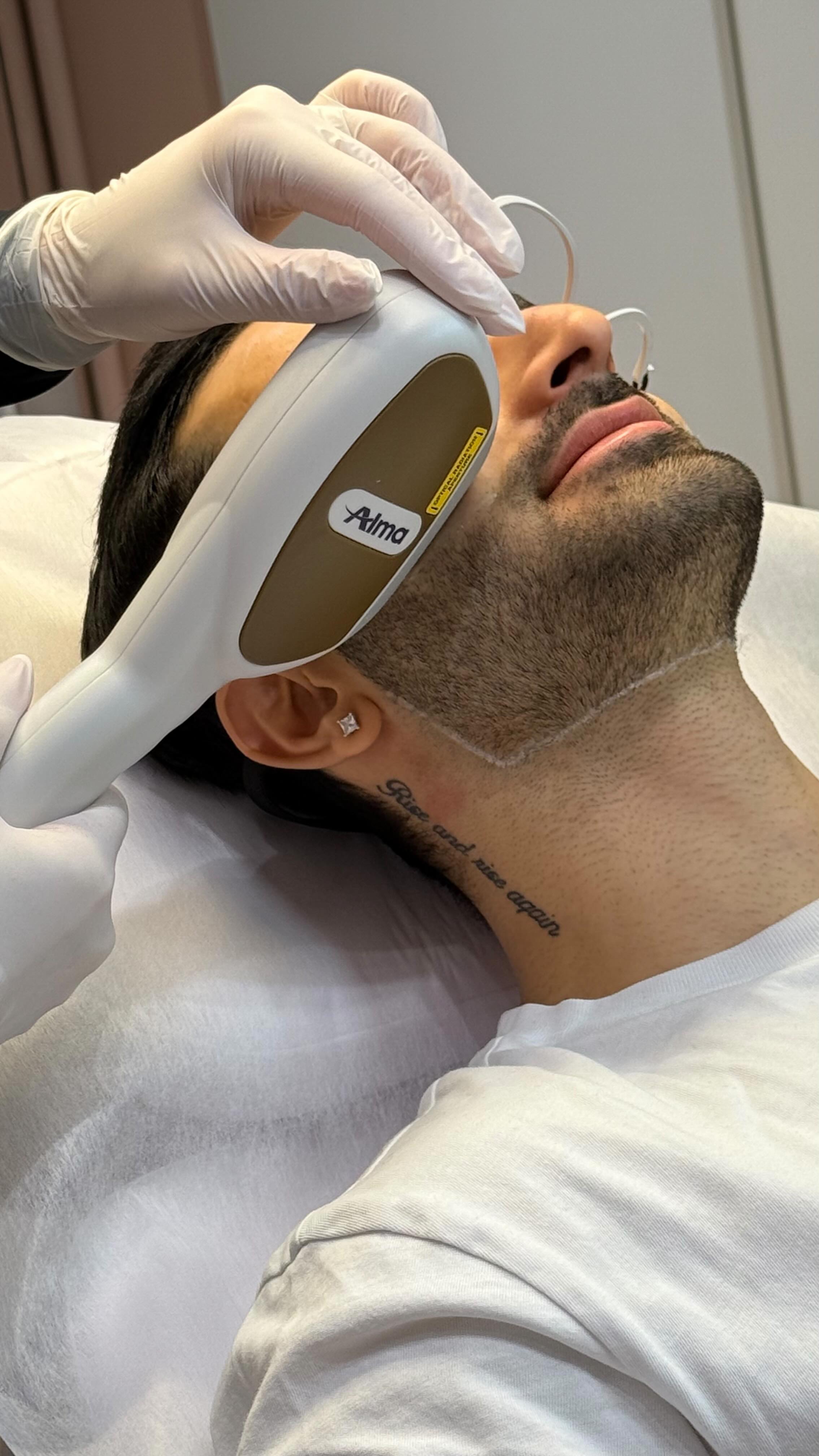 Partalinjan laserkarvanpoisto -50% alennuksessa rajoitetun ajan. 💥