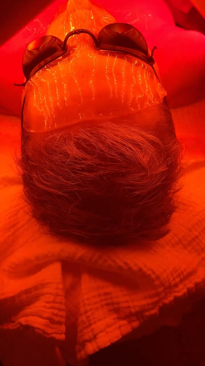 COUP DโรCLAT, FACIAL โจ: A Winter Skin Pick-Me-Up ๐งด๐ฅ#
Dry, dull winter skin? A โcoup dโรฉclatโ facial is your answer. It deeply hydrates, boosts radiance, and improves texture. Perfect for FEBRUARY when skin needs extra care. Expect cleansing, a hydrating mask, massage, and targeted serums. Combine with good home care as APIVITA day & night cream best results. โจโจโจAsk your esthetician for personalized recommendations.
* Drink plenty of water for skin hydration๐ฆ
#luxuryskincarre#selfcarethreads#professionalskincare#ledlighttherapyamsterdam#skincare#glowskin#coupdeclat#stralendehuid#netherlands๐ณ๐ฑ#5starsreview#lacremedelacreme#youngerskin#antipigmentation#plumpskin#antiaging#betteraging#50yearsold#