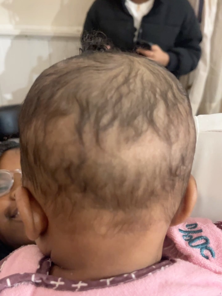 Scalp cleared! Hair growing! So grateful 🥹
God breathed hair care that’s blessing the babies too !
Product used: Honey hair oil (link in bio)