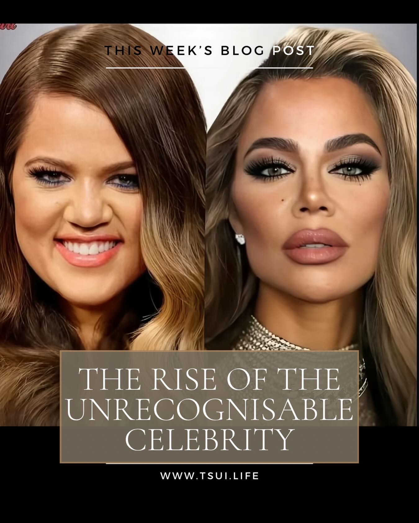 I’d love you to read this week’s post about the change in how celebs are now having surgery. The new standard of anti-ageing and what it means (if anything) for the rest of us.
#antiaging #cosmetic #cosmeticsurgery