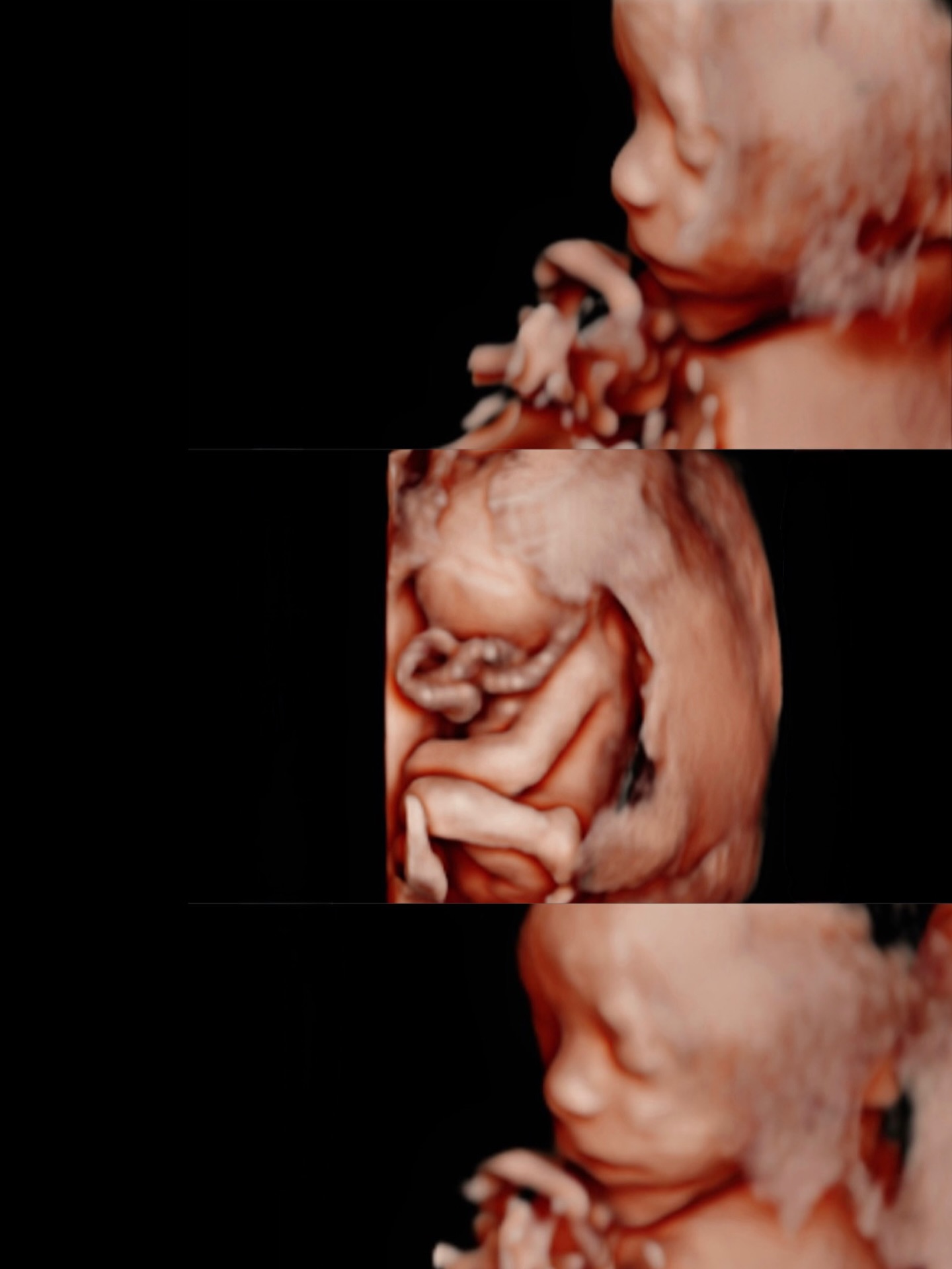 if you hit the halfway mark, this is how your baby looks! 🥹 21 weeks!
#pregnant #pregnancy #20weeks #ultrasound #explore