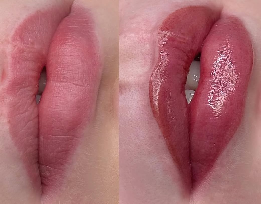 PMU LIPBLUSH
Scar correction
Work by Sofija ✨