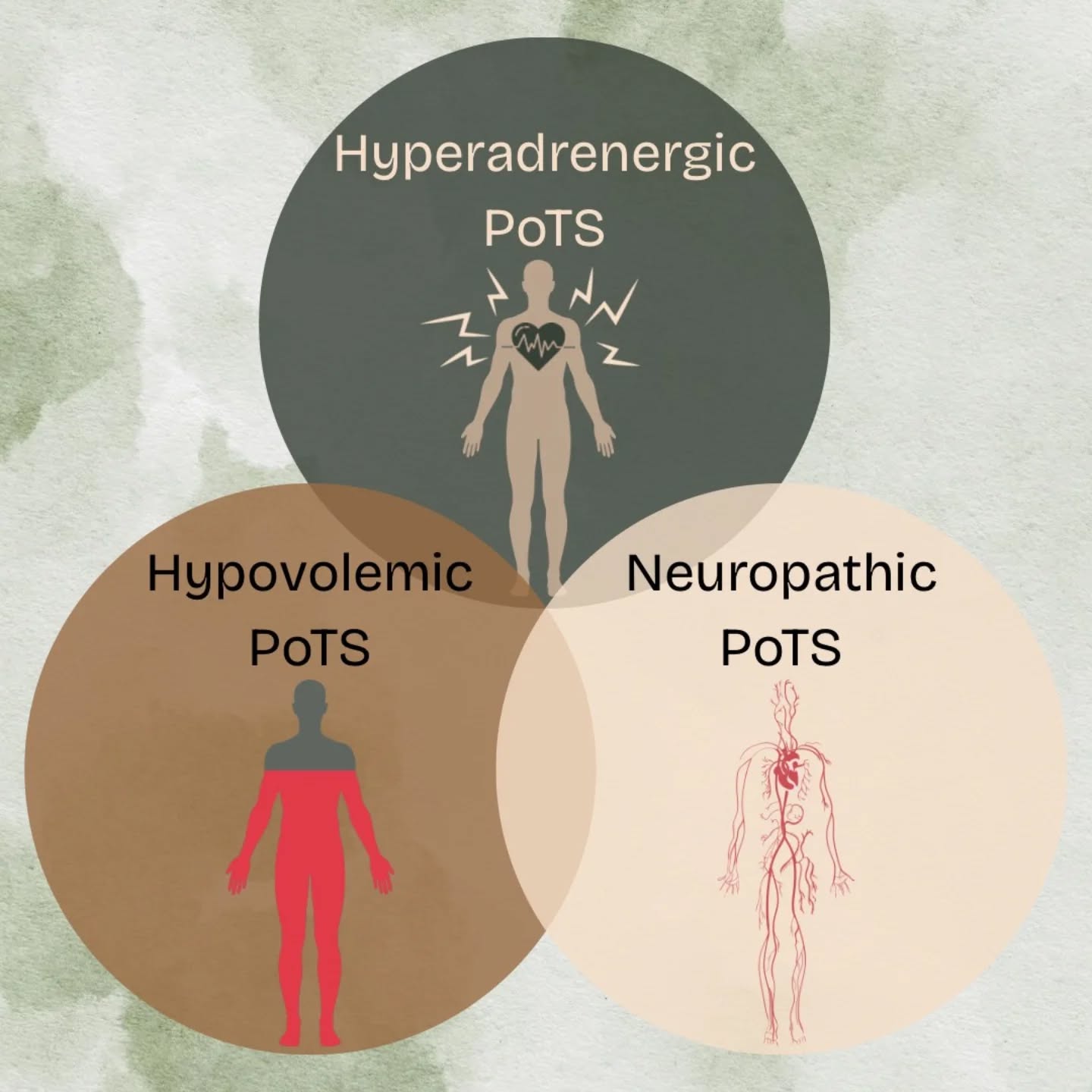 Hi all, I hope you're all grand 💙
After a rough year and half with flare ups and feeling like I've gone back 100 steps, I'm back to start sharing again my journey and the knowledge I've learnt along the way, in hopes that it helps others out there. This has definitely been a year of information overload.
When I first found out about PoTS and when I initially got a diagnosis with PoTS - I really didn’t understand much of it at all. Great, I have PoTS, an answer to how crap I’ve been feeling but what does any of that mean.
Since my diagnosis in September 2023, it’s only really in the last 6 months that I’ve really truly started understanding the complex world of it all and how it can really vary between people.
Over my last 6 years of symptoms and illness journey, I’m now starting to somewhat understand what is needed for my own recovery / management, and hoping even the little bit of knowledge I’ve learnt might be able to help others with their own journeys.
This leads us into then what I wish I was told when I was first diagnosed. The various subtypes of PoTS, how they vary and can overlap each other.
This is what my new post 'Where to Start - PoTS Subtypes' is all about. You can click the link in my bio which brings you to my blog.
Thanks for the read 🩵
#pots #potssymptoms #health #journey #subtypes