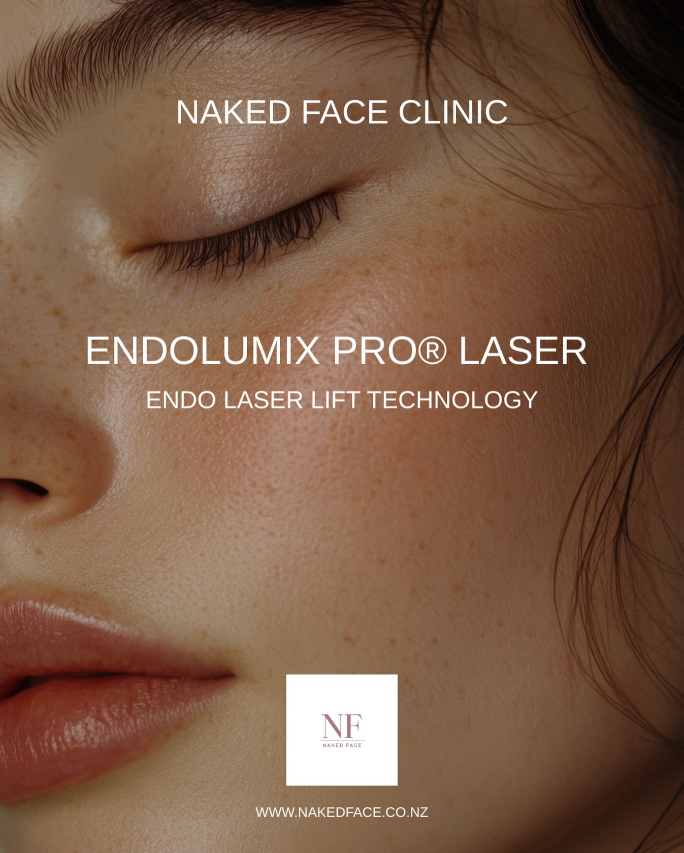 Endolumix Pro®
Powered by cutting-edge Endo Laser Lift technology
Meet the next generation of non-surgical skin rejuvenation.
Endolumix Pro® uses advanced dual laser technology to firm, tone and contour the face and body — stimulating collagen for a smoother, tighter, more sculpted look.
No scalpels.
No downtime.
Just next-level aesthetic innovation designed to lift and redefine your natural contours.
💎 Common treatment areas:
• Face & jawline
• Neck & under-chin
• Abdomen & thighs
• Knees & arms
📍 Available at Naked Face Clinic
Paremata, Wellington
🔗 Book your consultation or learn more today
Results and suitability vary between individuals. This treatment is for cosmetic enhancement only and does not replace medical or surgical procedures.
#botoxwellington #botoxporirua #botoxkapiti #botoxnz #fillerwellington