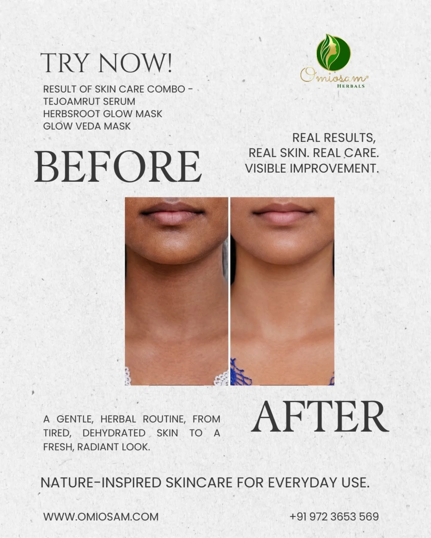 Real result of skincare combo product
Millions of happy customers.
Since 2013
✔ Suitable for all skin types
✔ Daily skincare–friendly formulation
✔ Lightweight, non-greasy serum
✔ Ideal for men and women
Shop Now
www.omiosam.com
+91 972 3653 569