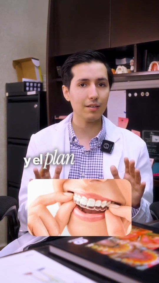 ¿Te preguntas qué es más efectivo: alineadores o brackets? 🤔
La respuesta depende de tu sonrisa, tus hábitos y tus objetivos.
🦷 Agenda tu valoración y toma la mejor decisión.
.
.
.
.
UANL Ced. Prof. 12948881
UANL Ced Maestria: 14532598
COFEPRIS: 2419032002A00440
.
.
.
#dentistamonterrey
#alineadores
#brackets
#dentistasanpedro
#Ortodoncista