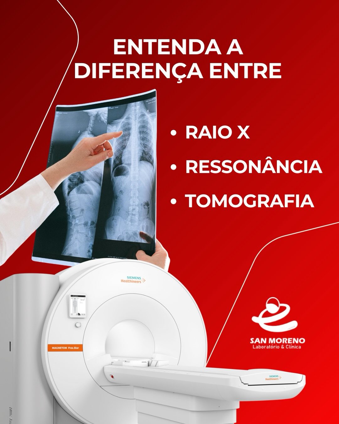 Cada exame de imagem tem uma função específica e é indicado de acordo com o que o médico precisa avaliar:
🔹 Raio-X
É um exame rápido e simples, que utiliza radiação em baixa dose. É muito utilizado para avaliar ossos, pulmões e alterações mais evidentes, como fraturas e infecções pulmonares.
🔹 Tomografia Computadorizada (TC)
Também utiliza radiação, porém em maior quantidade. Produz imagens em cortes detalhados, permitindo uma avaliação mais precisa de órgãos internos, ossos, sangramentos e traumas, sendo muito comum em situações de urgência.
🔹 Ressonância Magnética (RM)
Não utiliza radiação. Usa campo magnético e ondas de rádio, sendo o exame com maior definição para tecidos moles, como cérebro, medula, músculos, ligamentos e articulações.
👉 Por isso, nem sempre um exame substitui o outro. Cada um tem sua indicação específica e deve ser solicitado pelo médico.
🏥 Na Clínica San Moreno, você encontra todos esses exames em um só lugar, com tecnologia, conforto e uma equipe preparada para cuidar de você.
💬