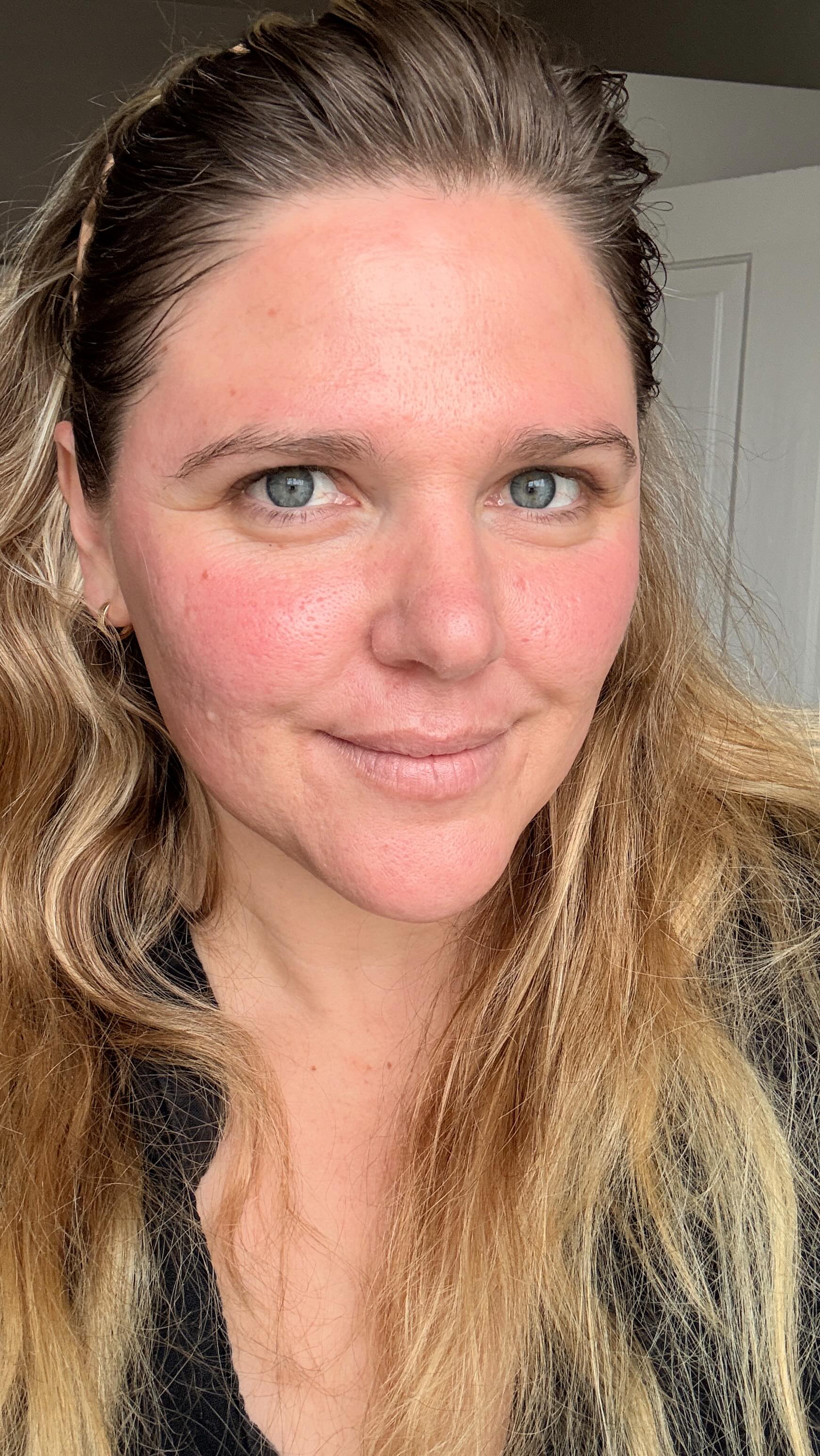 I went for a visit to The Spa Face and Body for a full glow up! @aesthetician.pammoore did all the things to get my face feeling refreshed. If self-care is on your new years list she’s your gal.
Epicutis Oil Cleanser
Dermaplane
Lymphatic Drainage Hydrafacial with 15% peel, extractions, Omorovicza Skin Renewal booster, red light LED light therapy
Epicutis Hydrobiome Mist
Epicutis Lipid Serum
Epicutis Hyvia
Epicutis Lipid Shield SPF mixed with Colorescience Face Shield “Glow”
Anfisa lip treatment
You don’t have to tell me I know I’m spoiled. Thanks Pam.