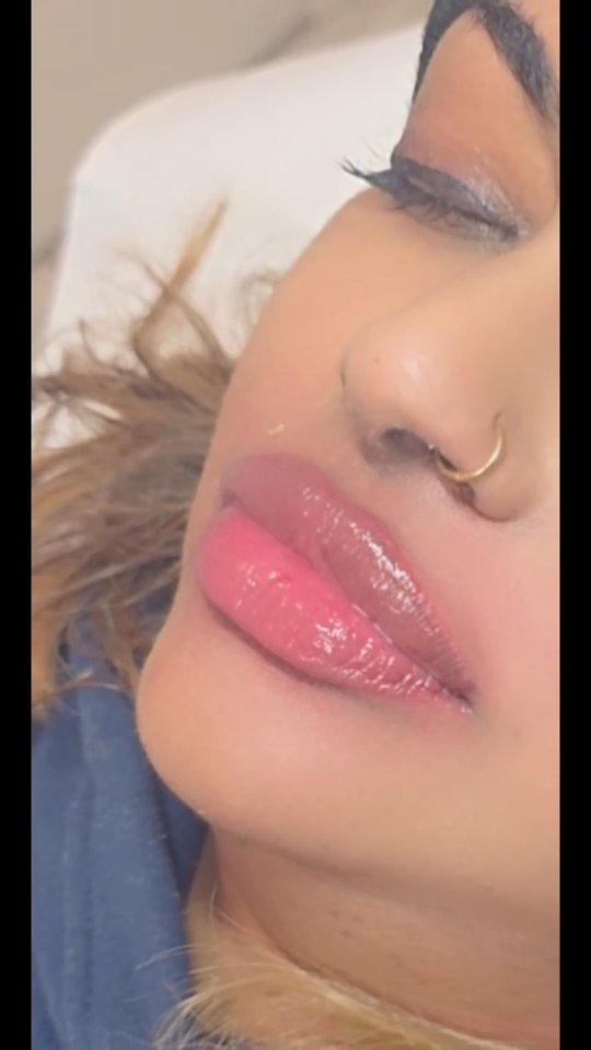 Watch me work ...
1ml lips
What a beaut...
Whats most rewarding about coming to work. Is seeing your faces at the end of your treatments
Thanks for trusting in us
We look forward to seeing you again
Keep an eye on your inboxes because this year you are in for some amazimg treats and offers
#lips #chingfordlips