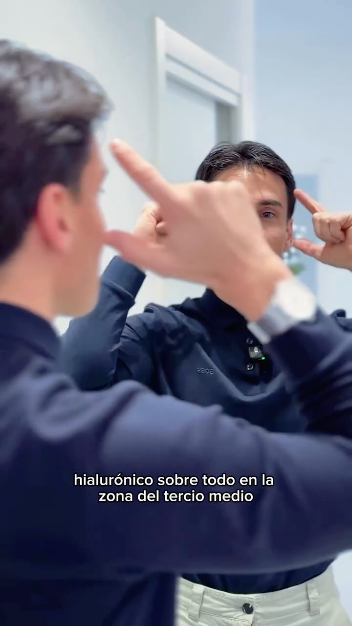 ✨ ¿Cuál es el tratamiento ideal para empezar en medicina estética?
No hay una respuesta única.
Porque no todos los rostros son iguales… ni necesitan lo mismo 👀✨
En este reel, el Dr. Martín explica algo clave:
a partir de los 30 años, en muchos casos los neuromoduladores son una de las mejores opciones para empezar 💉🤍
¿Por qué?
Porque no rellenan ni cambian tu rostro, sino que actúan relajando el músculo que se contrae en exceso, consiguiendo una expresión más descansada, natural y armónica.
En algunos casos, el tratamiento puede complementarse con ácido hialurónico, especialmente en el tercio medio del rostro, pero siempre con criterio médico y sin buscar volúmenes exagerados.
En Clínica Cuidem tenemos algo muy claro:
✨ no transformamos rostros
✨ no exageramos volúmenes
✨ realzamos lo que ya tienes de forma sutil
✨ valoramos el rostro de manera integral
Por eso, todo empieza con una primera valoración personalizada.
Escuchamos tus preocupaciones, analizamos gestos, musculatura y estructura facial… y te asesoramos con honestidad.
👉 Si estás pensando en empezar en medicina estética, pide tu primera valoración con el Dr. Martín y deja que un profesional te guíe en lo que realmente necesitas (o no) 🤍✨
#MedicinaEstética #ResultadosNaturales #Neuromoduladores #ClínicaCuidem #ValoraciónFacial BellezaConCriterio