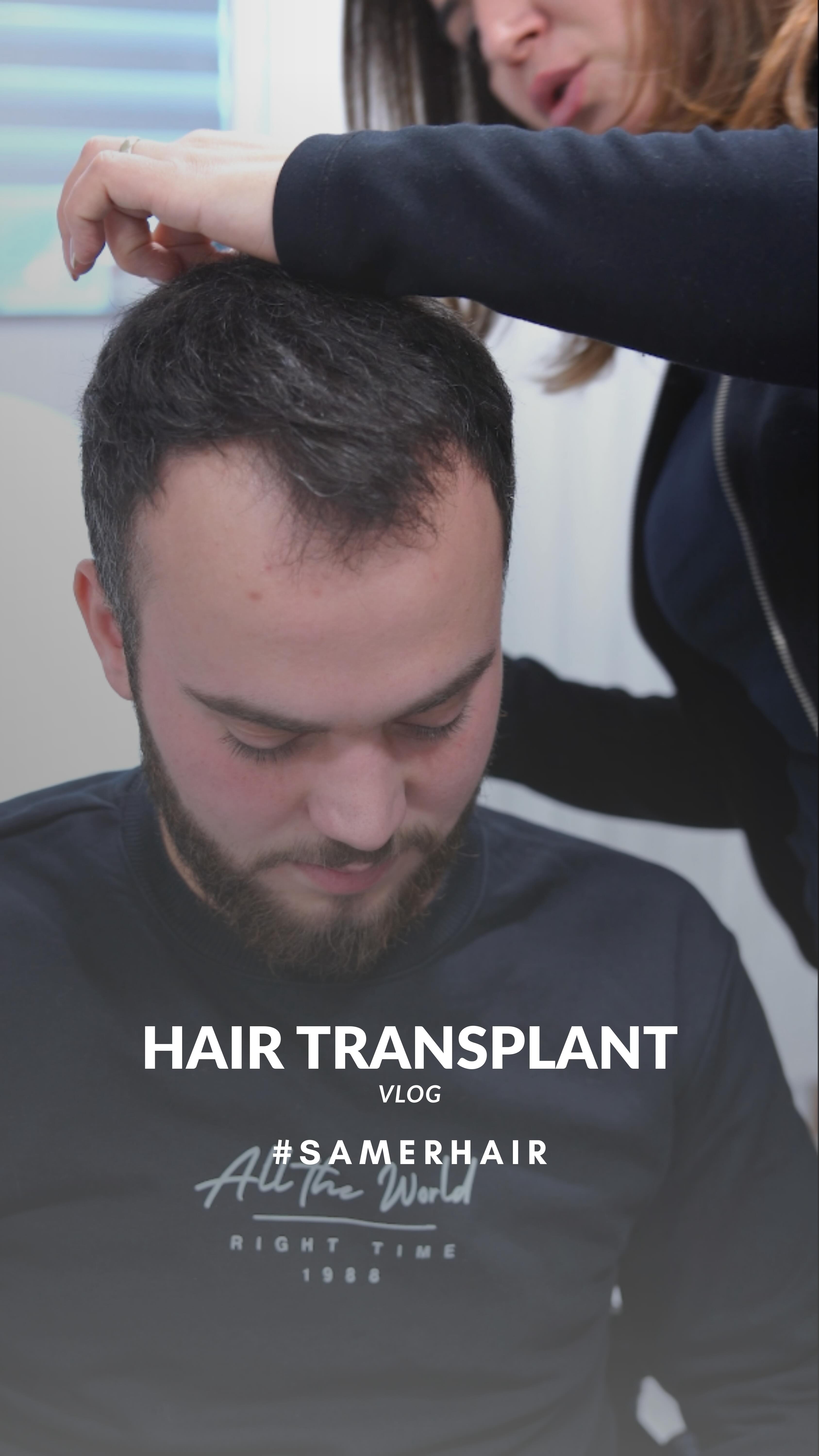 SamerHair’de saçlarınız yeniden hayat bulsun ✨
Özgüveninizi geri kazanın, değişimi hissedin 💪🔥
Let your hair come back to life at SamerHair ✨
Regain your confidence and feel the change 💪🔥
В SamerHair ваши волосы обретают новую жизнь ✨
Верните уверенность и почувствуйте перемены 💪🔥
-
-
-
-
-
#hairtransplant #hairtransplantturkey #saçekimi #istanbulhair #beforeafter