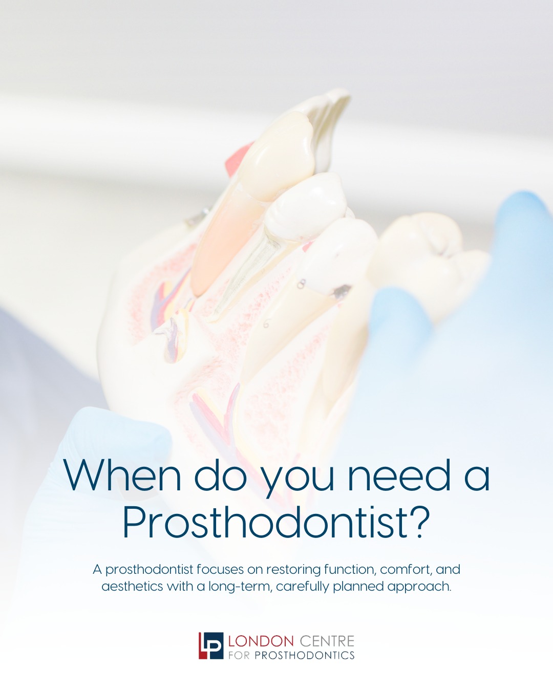 You may benefit from seeing a prosthodontist if you…
• Have missing teeth and are considering implants, bridges, or dentures
• Need multiple crowns, bridges, or veneers
• Have worn, broken, or heavily restored teeth
• Experience bite problems, jaw discomfort, or repeated dental failures
• Are considering a full smile or full-mouth rehabilitation
A prosthodontist focuses on restoring function, comfort, and aesthetics with a long-term, carefully planned approach.
Get in touch with our team to book your appointment - we look forward to seeing you soon!
The London Centre For Prosthodontics
29 Weymouth Street
London, W1G 7DB
020 7637 4518
info@londonprosthodontics.com
Monday - Friday: 7:30am - 4:30pm
#SmileMakeover #EmergencyDentistLondon #LondonDentalClinic #SmileTransformation #CosmeticDentistLondon