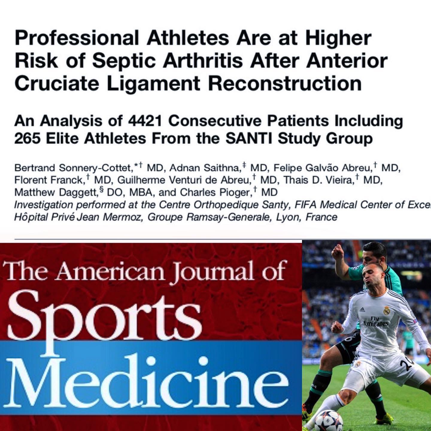Fantastic publication from the SANTI group about the risk of infection after ACLR 👏. In my daily practice, I apply a Vancomycin pre-soaking of the graft intra-operatively to reduce that risk. #santigroup #kneesurgery #aclreconstruction #sportsmedicine