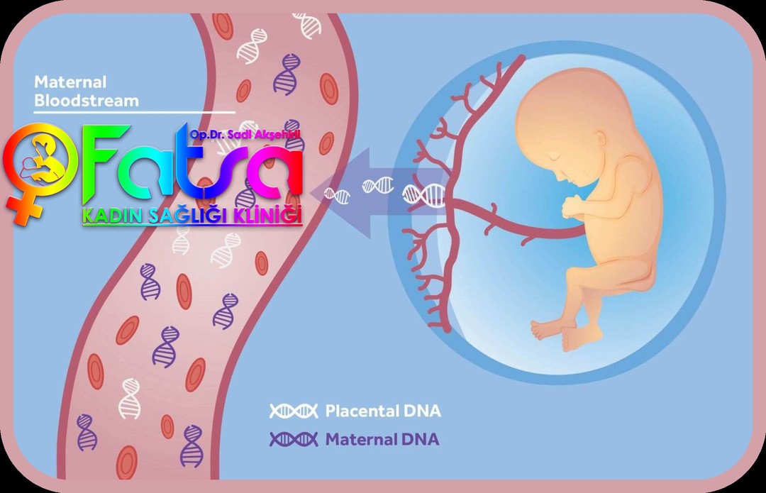 İkili Test Sonuçları Her Zaman Doğru mu? Doğru değilse nasıl anlaşılır ?
🌟 Dörtlü Tarama Testi Neden Daha Kapsamlı? 🌟 Dörtlü tarama testi, ikili tarama testine göre daha kapsamlıdır ve bazı fetal durumları yakalamada daha başarılı olabilir. Bu test, annenin kanındaki dört farklı maddeyi ölçerek, bebeğin belirli genetik ve kromozomal anomalilere sahip olma riskini değerlendirir.
✨ 💡 Peki, dörtlü test ile ikili test arasındaki farklar neler? 👇 👇
Dörtlü testin yakalayabildiği ancak ikili testte anlaşılamayan bazı durumlar şunlardır:
🔹 1. Nöral Tüp Defektleri: Nöral tüp defektleri, omurga ve beyin gelişiminde sorunlara yol açabilen doğum kusurlarıdır. En bilinen örneği "spina bifida"dır. 🧠 Dörtlü test, AFP seviyelerini ölçerek bu riski gösterebilir.
🔹 2. Trizomi 18 (Edwards Sendromu): Dörtlü test, nadir görülen Trizomi 18'i tespit etmede ikili testten daha duyarlıdır. Trizomi 18, ciddi gelişimsel sorunlara yol açabilir. 🔬
🔹 3. Smith-Lemli-Opitz Sendromu (SLOS): Bu sendrom, östriol seviyesinin düşüklüğüyle ilişkilendirilen genetik bir bozukluktur ve dörtlü test, bu sendromun tespitine yardımcı olabilir. SLOS, zihinsel ve fiziksel gelişim sorunlarına yol açabilir. 🧬
🔹 4. Diğer Doğum Kusurları: Dörtlü test, abdominal duvar defektleri gibi yapısal anormallikleri de tespit edebilir. İkili test bu konuda sınırlı kalabilir.
🔹 5. Preeklampsi Riski: Dörtlü testte ölçülen biyokimyasal belirteçler, annenin preeklampsi riskini tahmin etmeye yardımcı olabilir. 💉
🔹 6. Fetal Gelişim Problemleri: Düşük doğum ağırlığı ve büyüme geriliği gibi sorunların erken belirtilerini dörtlü testle öğrenebilirsiniz. 🤱
📌 Sonuç: Dörtlü tarama testi, daha geniş kapsamlıdır ve nöral tüp defektleri, Trizomi 18, Smith-Lemli-Opitz sendromu gibi önemli durumları yakalama konusunda daha başarılıdır. İkili test bazı sorunları gözden kaçırabilir; bu nedenle dörtlü tarama testi güvenilir bir seçenek olarak değerlendirilmelidir.
🌸✨ #DörtlüTaramaTesti 🌿 #GebelikTestleri ✔️ #BebekSağlığı 🍼 #Trizomi18 🧬 #NöralTüpDefekti 🧠 #SmithLemliOpitzSendromu 🔬 #Preeklampsi 🌼 #HamilelikSüreci 🤰 #BilinçliAnneler 💖 #SağlıklıBebek 🌟 #TaramaTestleri 🧡 #İkiliTest 🌸 #AnneAdayları 🤱