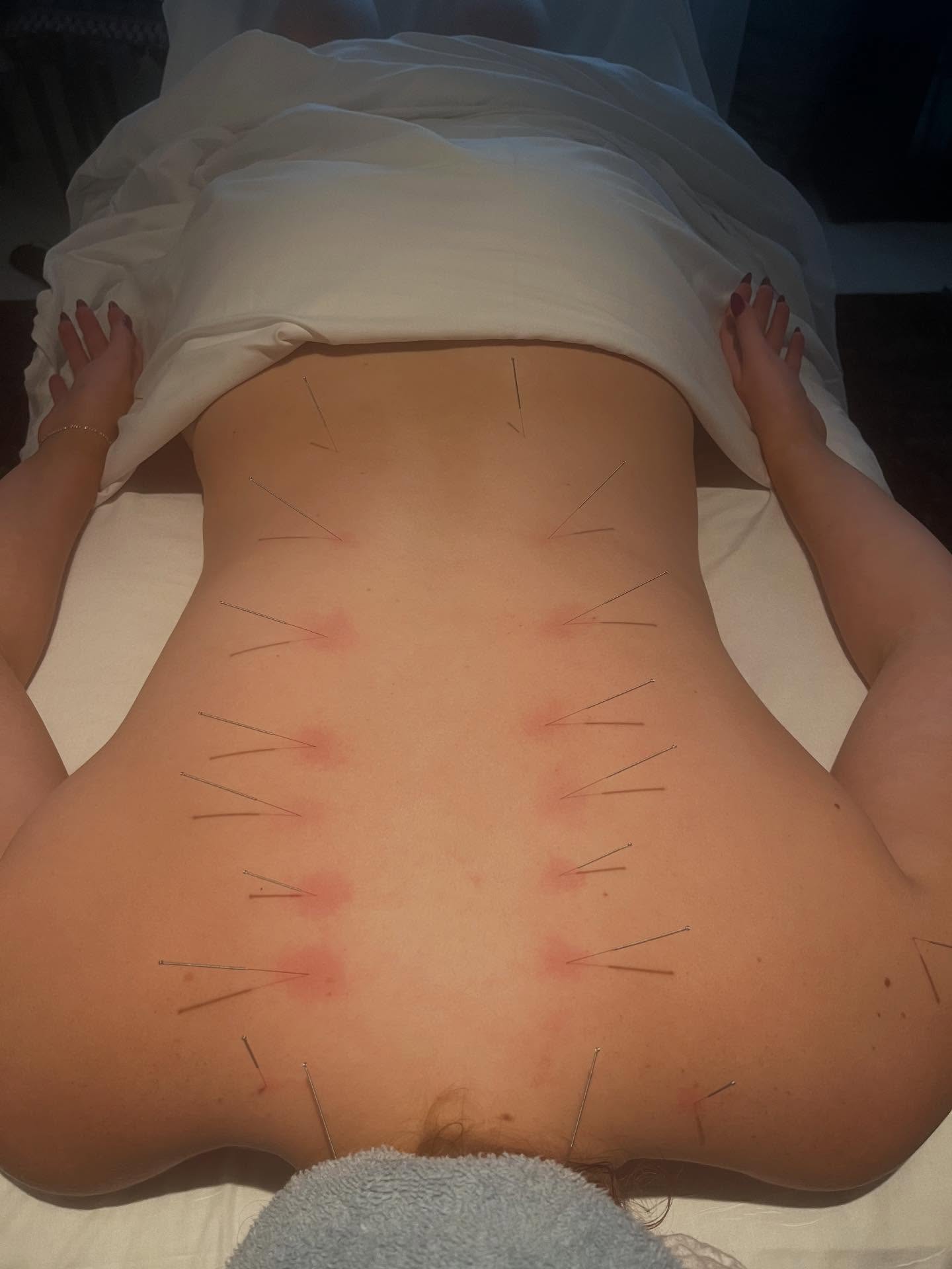 Acunap. The deep space of relaxation that you return to when you are resting your nervous system; boosting immunity; and releasing serotonin, dopamine, and norepinephrine to promote healing and well being, during your acupuncture session. 💤💤💤
Warm tables and infrared lamps await you. 🌞