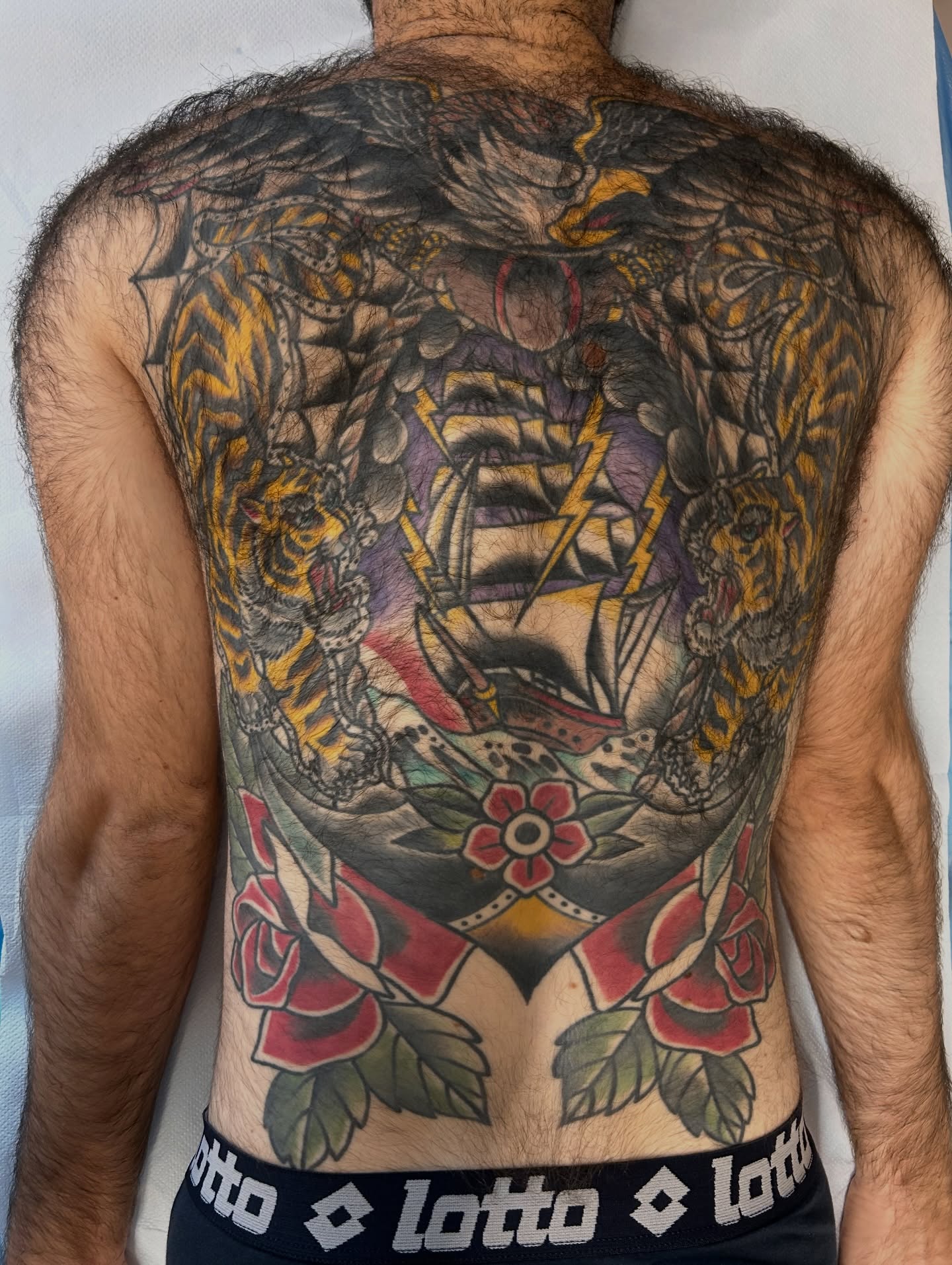 Sempre più spesso arrivano in ambulatorio pazienti giovani per la mappatura dei nei.
In alcuni casi, come questo, una schiena completamente tatuata può rappresentare un limite importante per la diagnosi precoce dei tumori cutanei.
Non si tratta di essere contrari ai tatuaggi, ma di conoscere le conseguenze: la epiluminescenza richiede la valutazione di colori, strutture e variazioni nel tempo, elementi che il pigmento del tatuaggio può mascherare.
La prevenzione passa anche da scelte consapevoli: lasciare porzioni di pelle libera, soprattutto in aree difficili da controllare autonomamente, può fare la differenza.
Informare oggi significa proteggere la pelle domani. 🩺