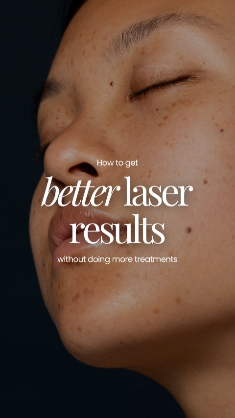 If you're still going for lasers that only address a single skin concern, it's time for a change.🫣
Try Astute's Signature Fusion Laser and feel the difference with our comprehensive laser experience that addresses both superficial and deeper skin issues such as pigmentation, scars and uneven skin texture — all in the same session.
Drop us a message to get started on your customized laser treatment plan today! ☺️