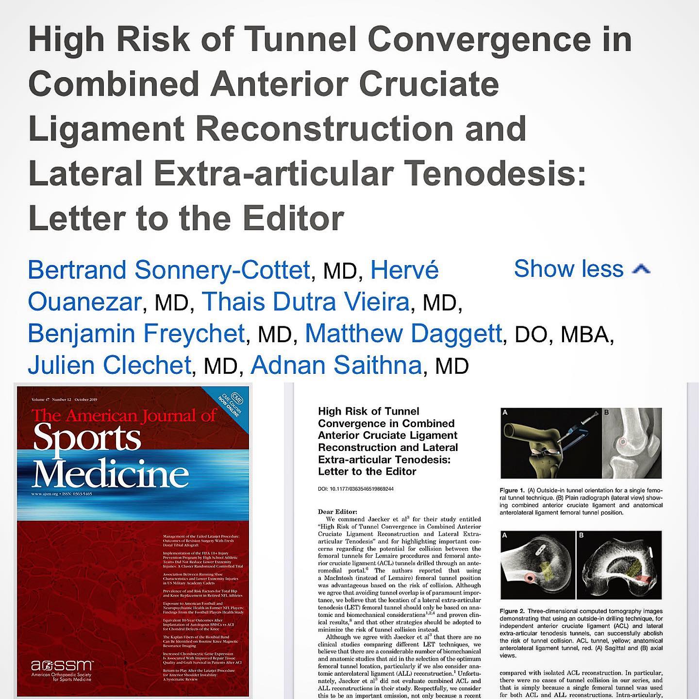 « No problem, only solutions »
#santigroup #sportsmedicine #kneesurgery #mydubai #aclsurgery