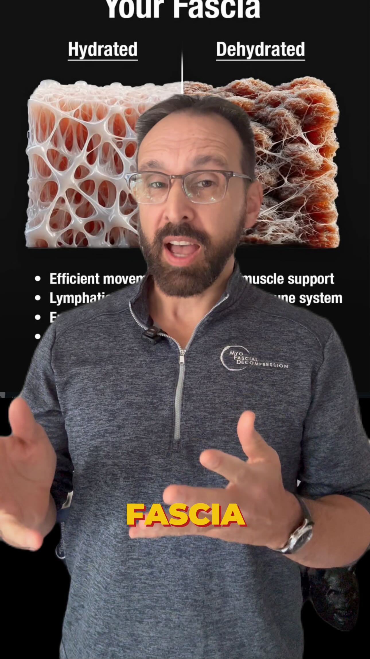 “Your fascia is dehydrated because you did too many deadlifts.” - said no one ever with half a brain. Yet we see this all over IG right now. Don’t let fitness gurus or extreme manual therapists scare you out of doing “the wrong exercises.” The body loves to move, period.
⭕️
Pain isn’t proof your fascia needs lotion.
It’s usually a sign that tissue capacity and nervous system tolerance have dropped.
⭕️
Unfortunately some manual therapists and groups like functional patterns are weaponizing fascial science terminology to fit their agenda to sell you their form of movement health. If they really wanted to be scientifically accurate they would do a study looking at their way vs standard exercise with pre and post MRI water mapping (like diffusion tensor imaging), T2 relaxation changes specifically in the ECM, or biochemical water quantification. But they won’t, becauee they can sell more with fake claims. Dont fall for it.
⭕️
You want to read the best we have on this subject at this point? Check out:
PMID: 32498422
PMID: 30417344
Neither has directly measured water content in fascia.
Also check out PMID: 19111259 for a really unique study on degenerative disc disease
⭕️
Aging is definitely associated with changes in extracellular matrix structure and mechanical properties, but much of this appears to correlate with reduced physical activity, altered loading, and overall health behaviors rather than age itself being the direct cause 🤓 TMYK 💪🏽 #fascia #functionalpatterns #healthyfascia #movemore